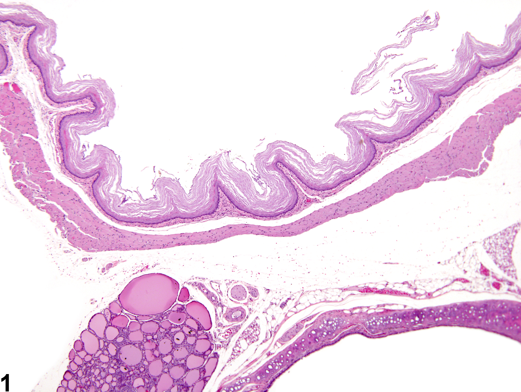 Image of hyperkeratosis in the esophagus from a female F344/N rat in a chronic study