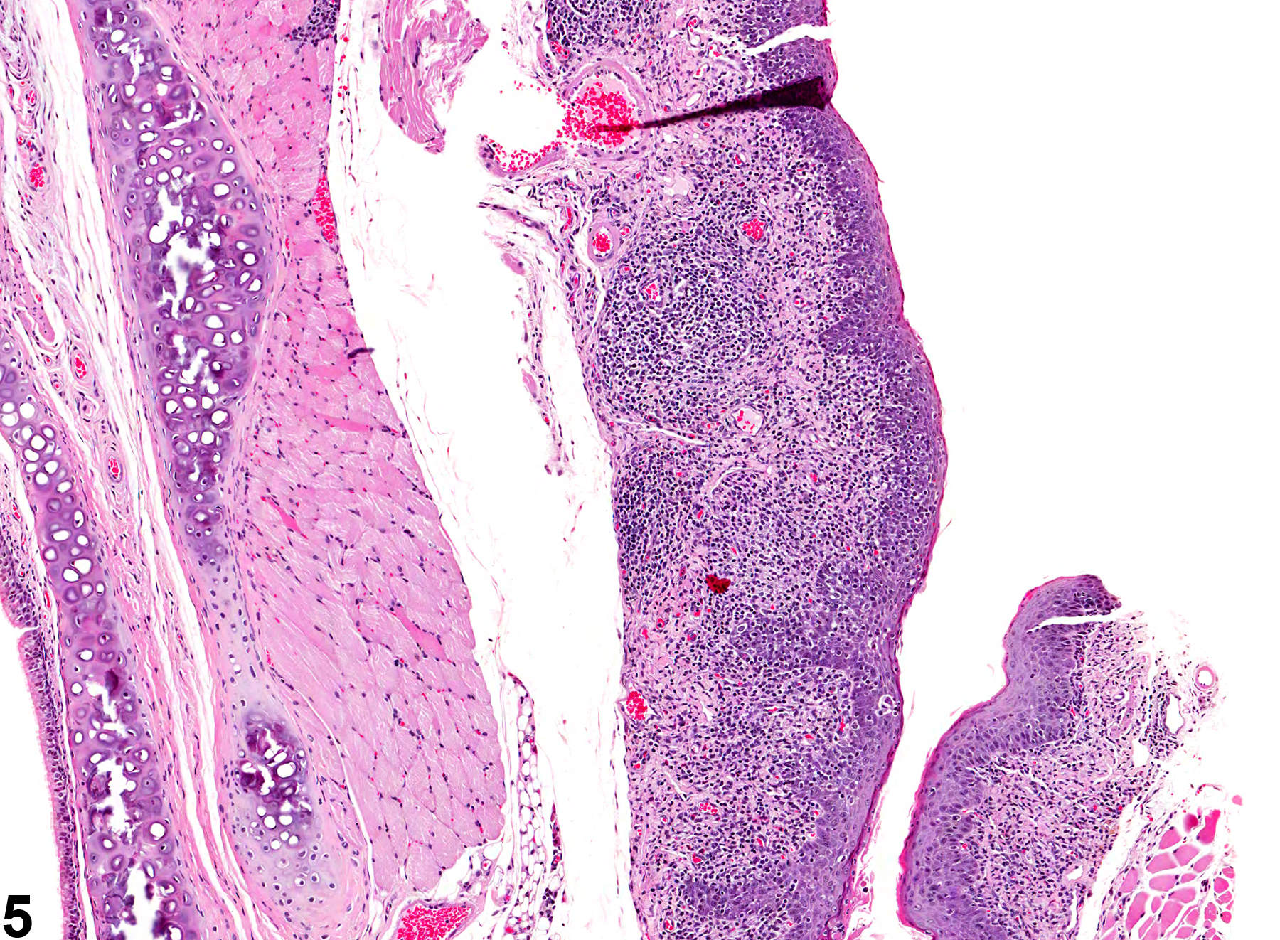 Image of inflammation in the esophagus from a female F344/N rat in a chronic study