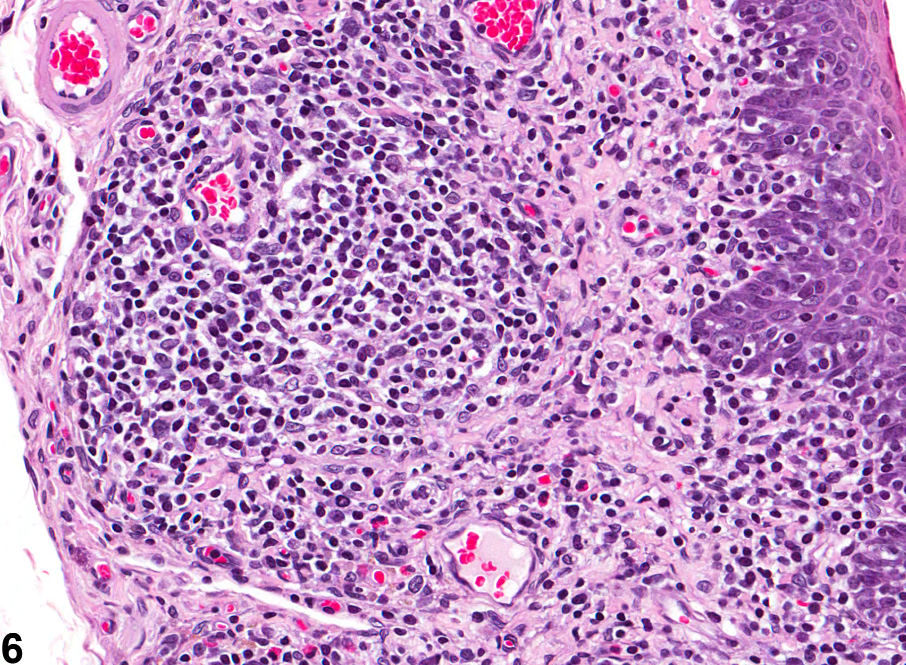 Image of inflammation in the esophagus from a female F344/N rat in a chronic study