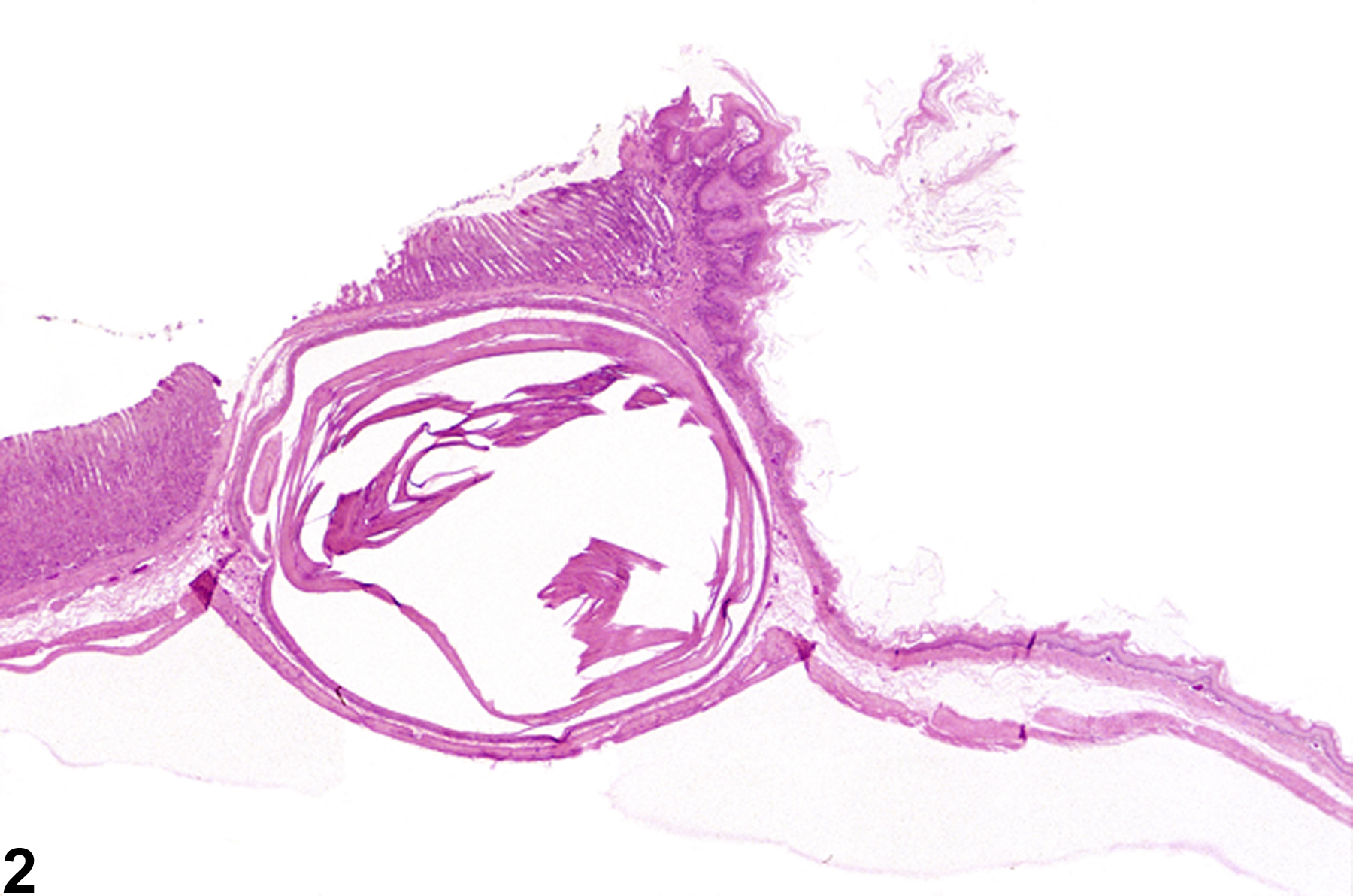 Image of cyst in the forestomach from a female F344/N rat in a chronic study