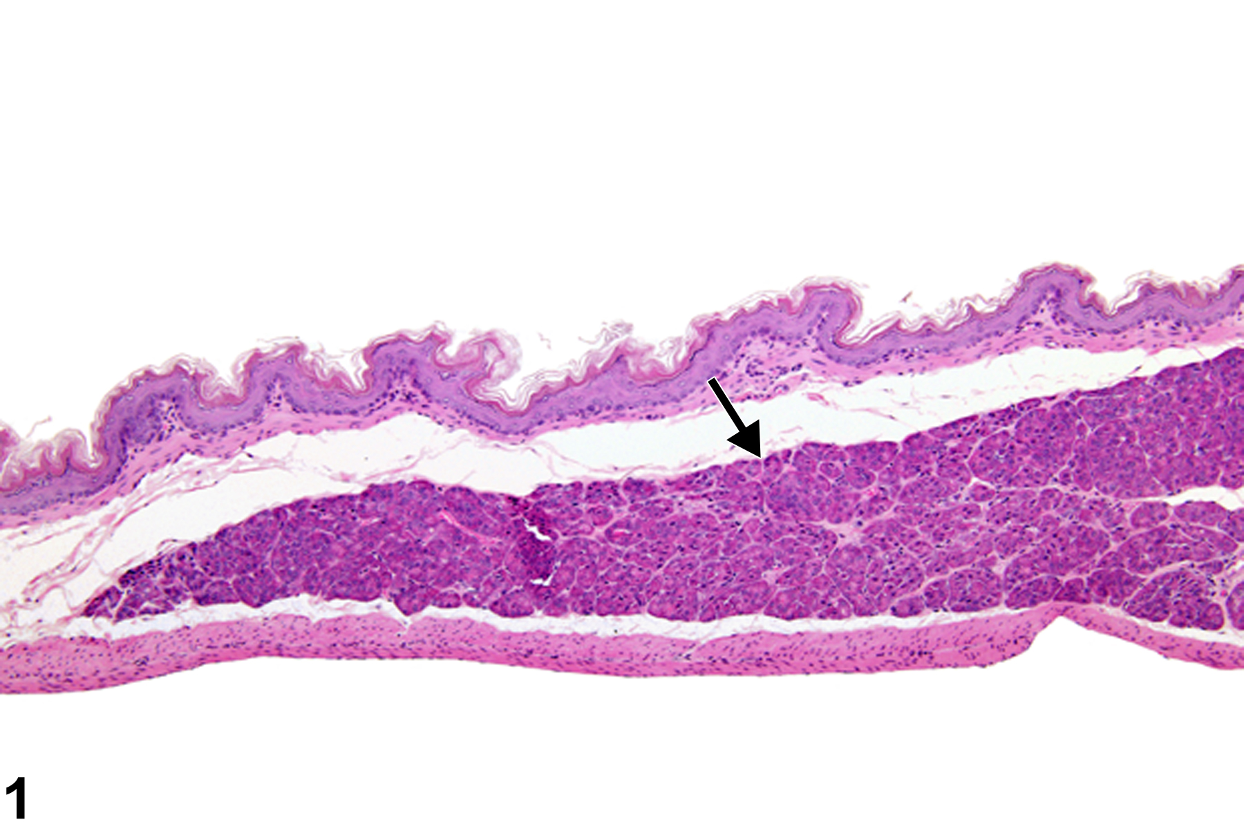 Image of ectopic tissue in the forestomach from a female B6C3F1 mouse in a chronic study