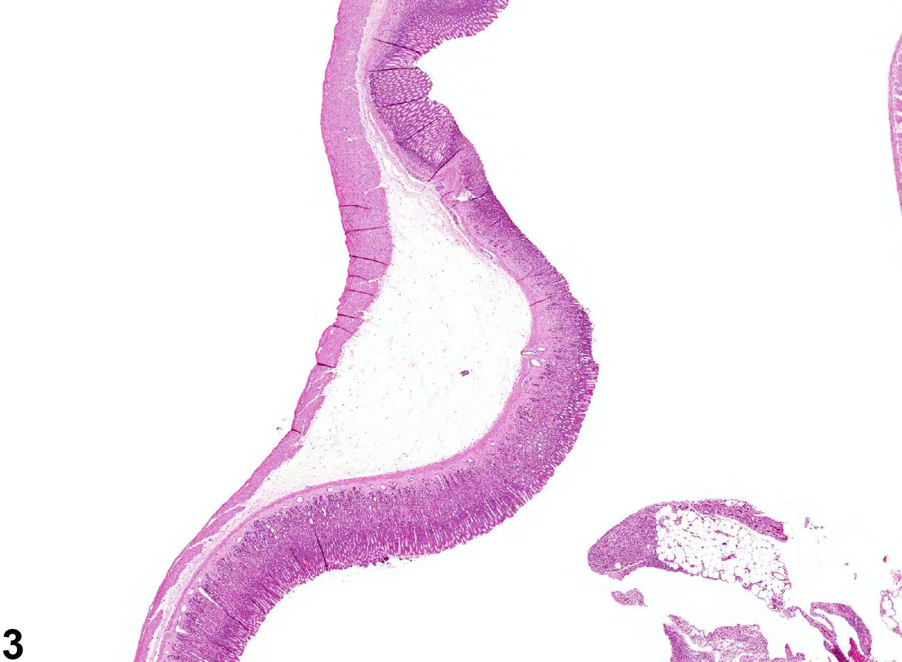 Image of edema in the glandular stomach from a female B6C3F1 mouse in a chronic study