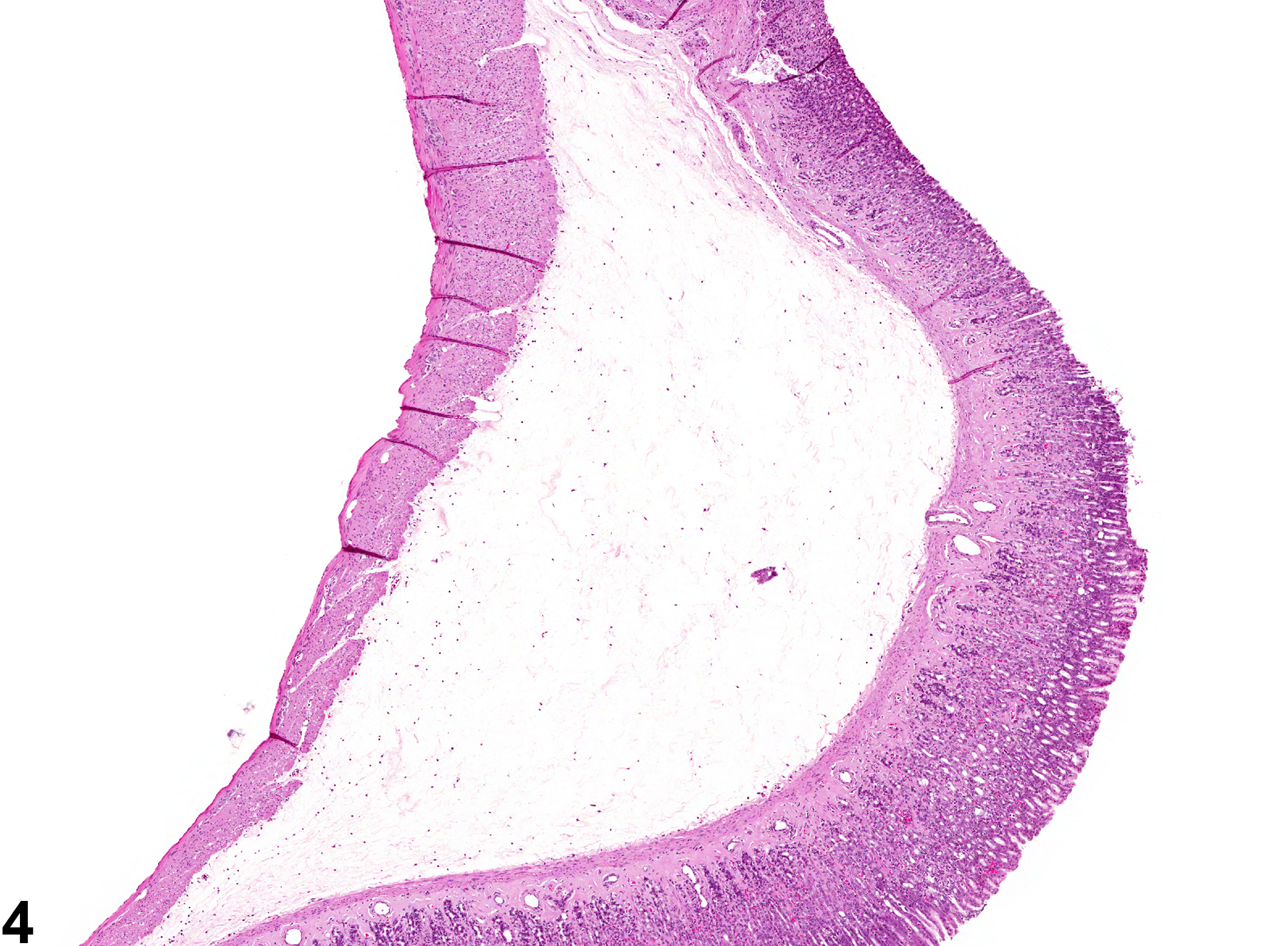 Image of edema in the glandular stomach from a female B6C3F1 mouse in a chronic study