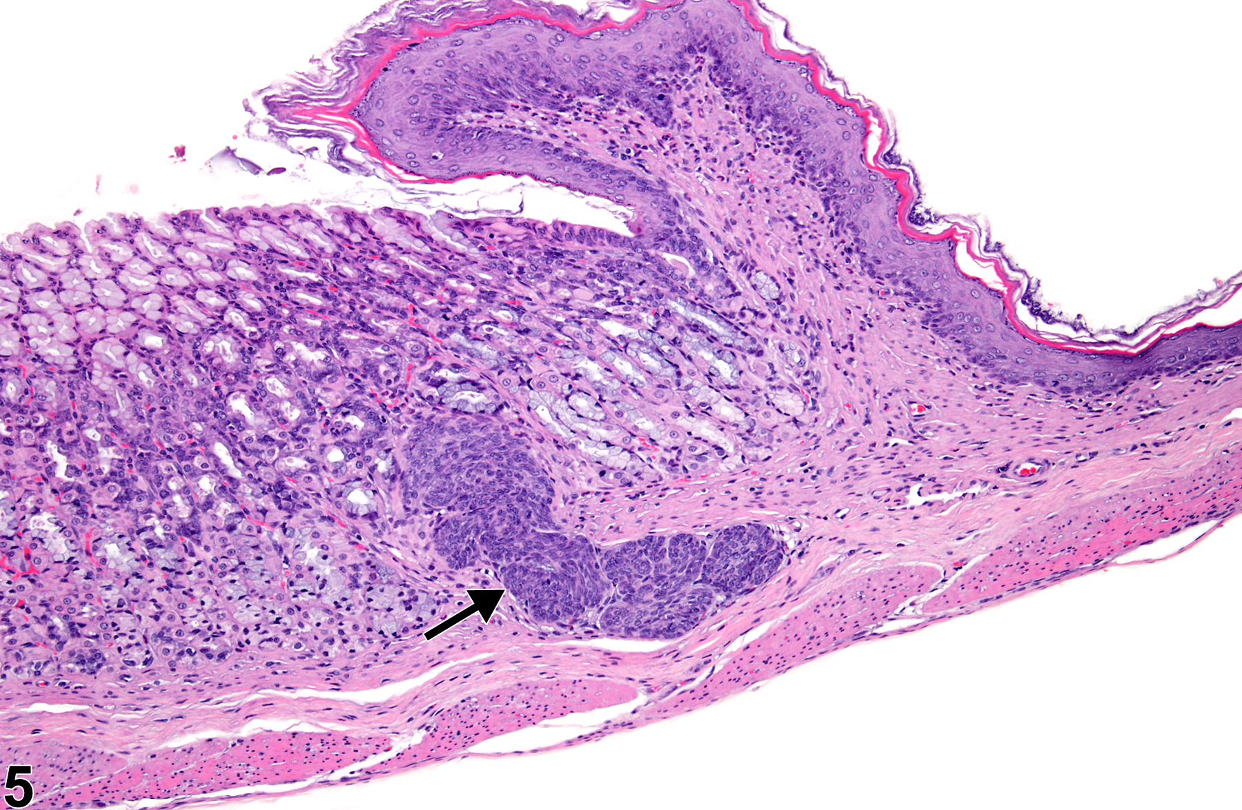 Image of hyperplasia in the glandular stomach epithelium from a female F344/Ntac rat in a subchronic study