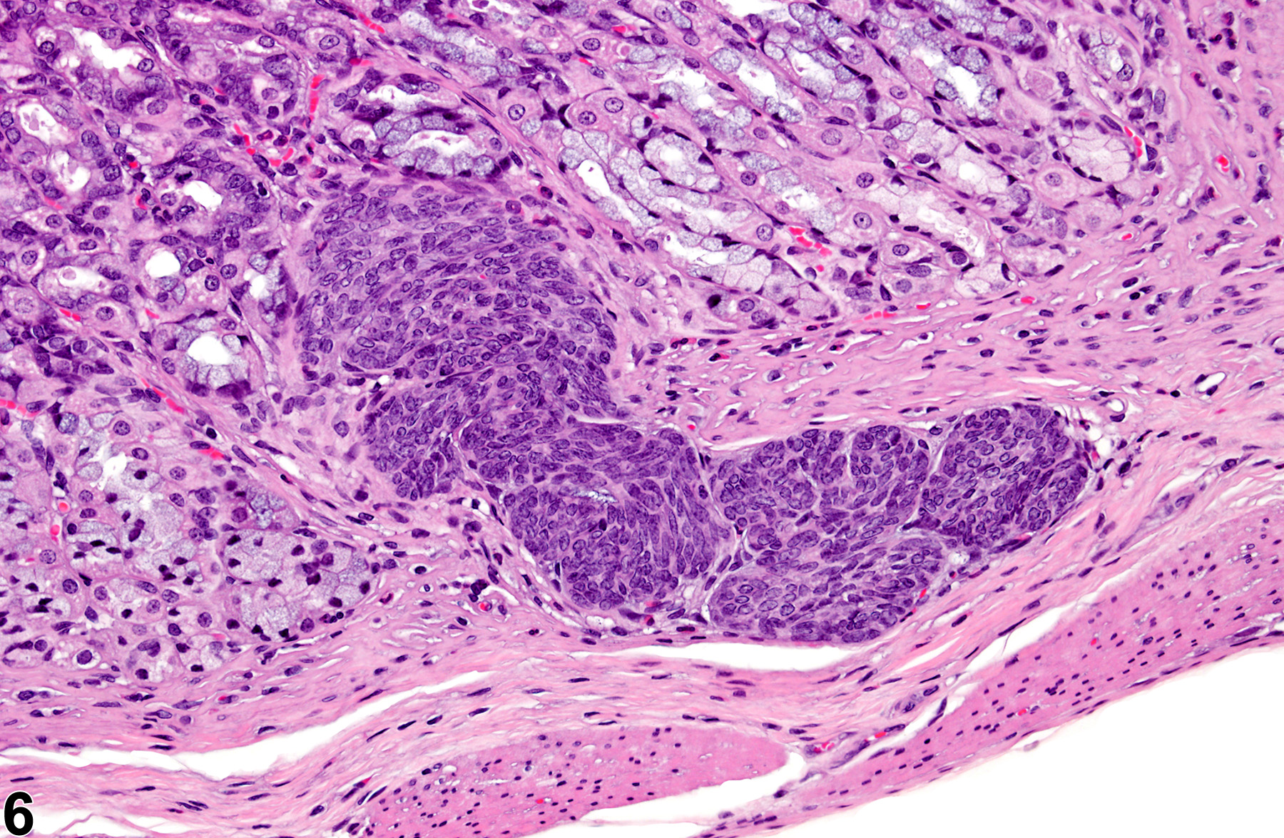 Image of hyperplasia in the glandular stomach epithelium from a female F344/Ntac rat in a subchronic study