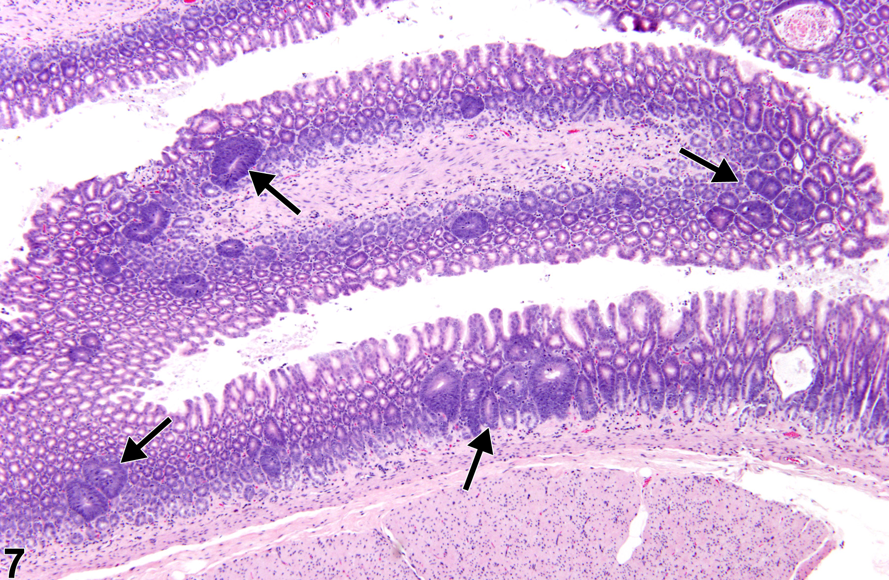 Image of hyperplasia in the glandular stomach epithelium from a male F344/N rat in a chronic study