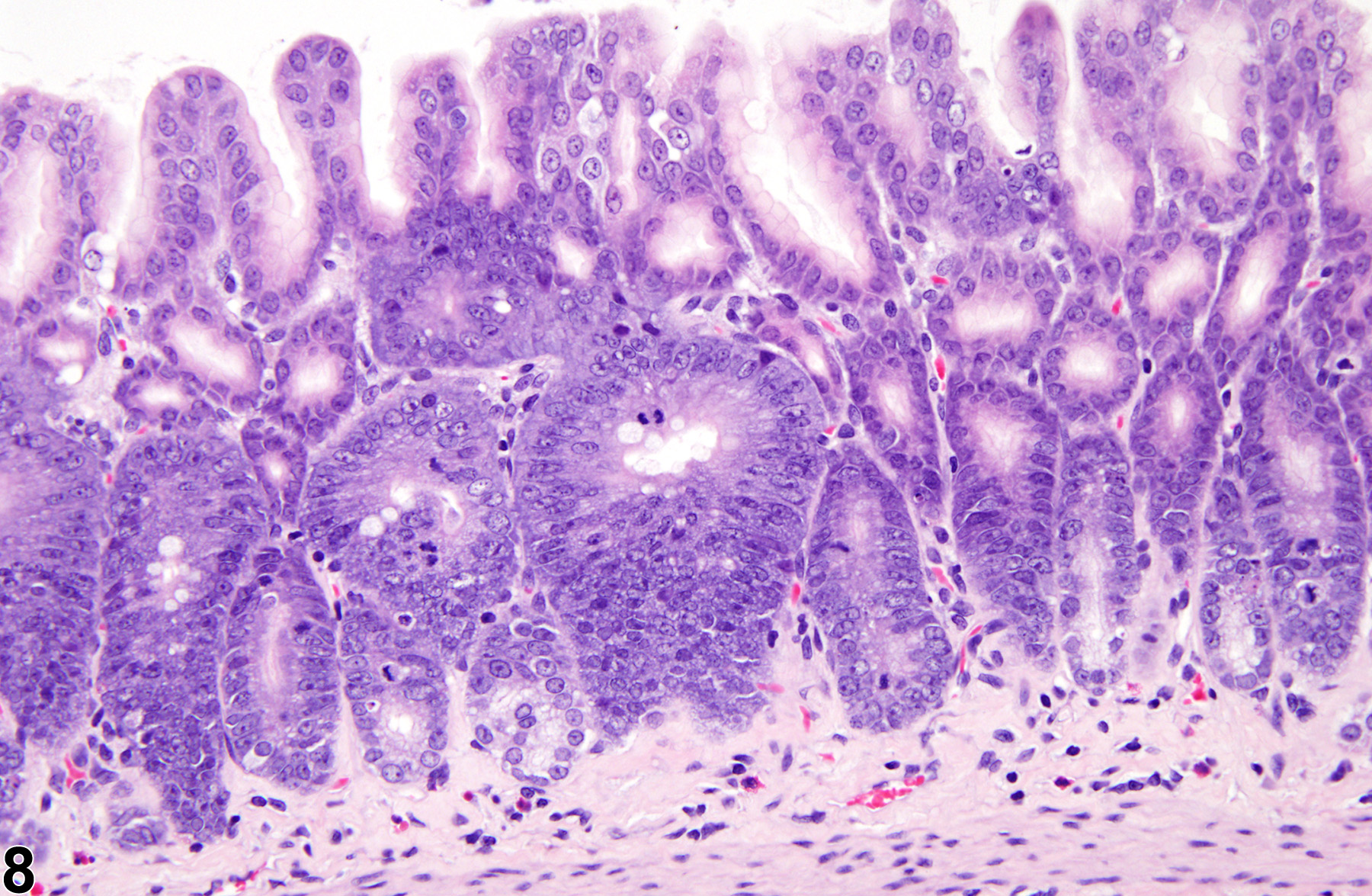 Image of hyperplasia in the glandular stomach epithelium from a male F344/N rat in a chronic study