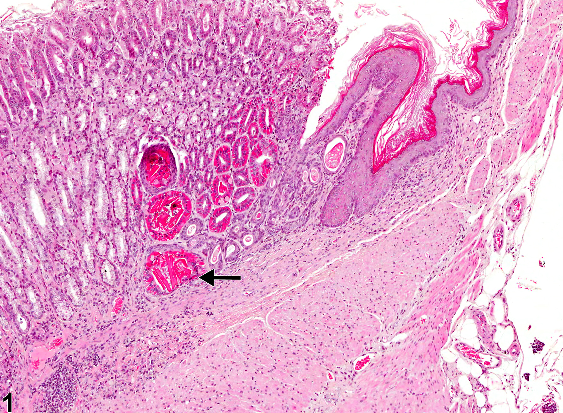 Image of hyaline droplet in the glandular stomach from a female B6C3F1 mouse in a chronic study