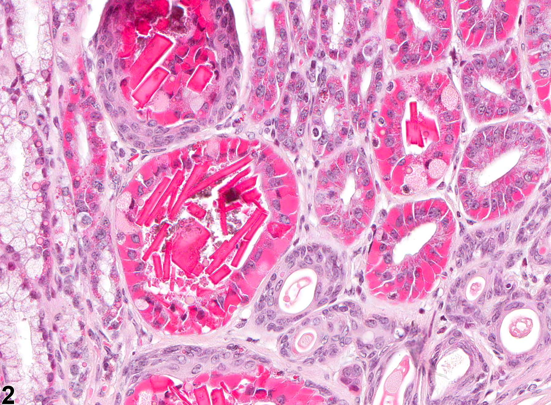 Image of hyaline droplet in the glandular stomach from a female B6C3F1 mouse in a chronic study