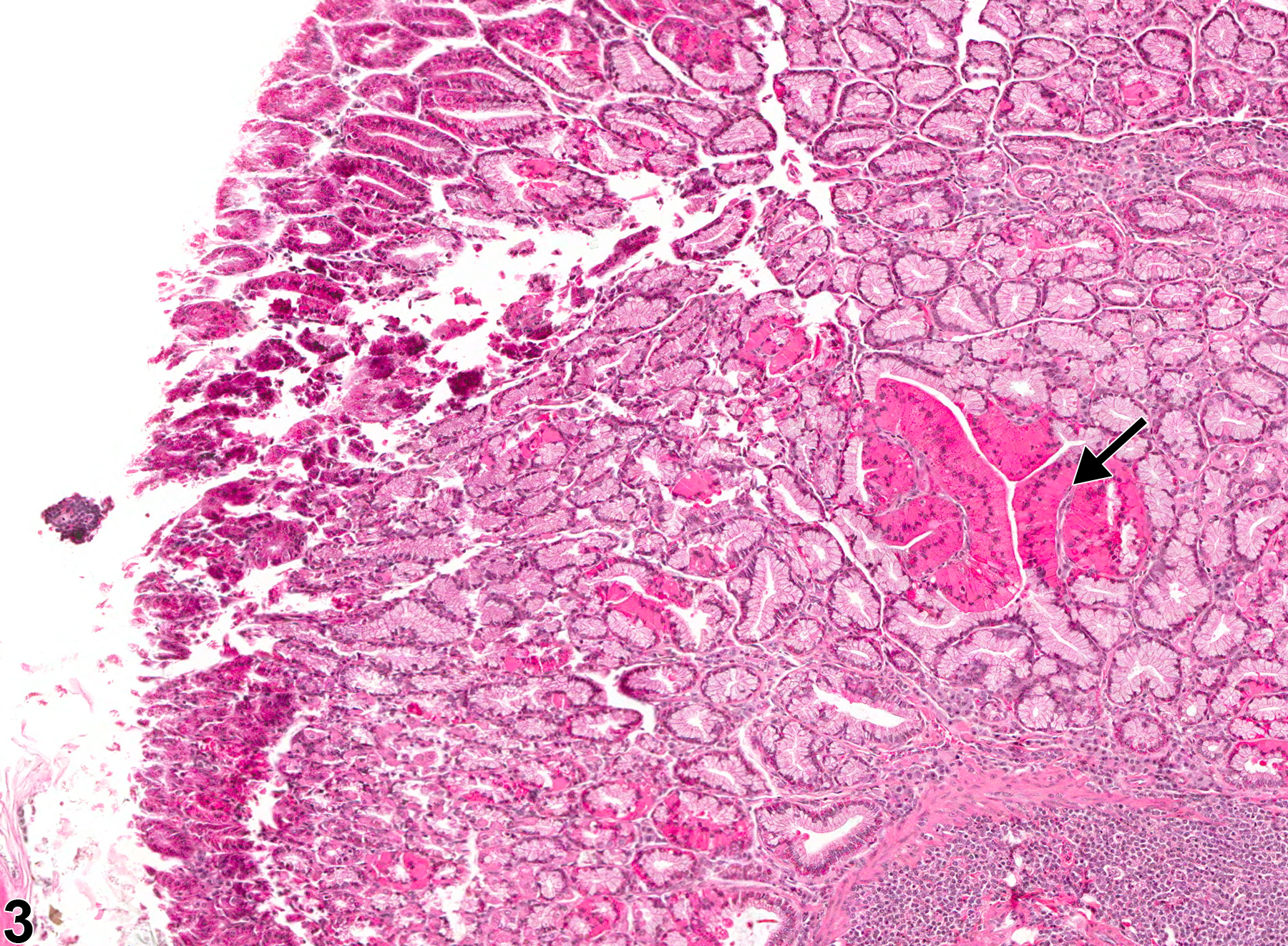 Image of hyaline droplet in the glandular stomach from a female B6C3F1 mouse in a chronic study