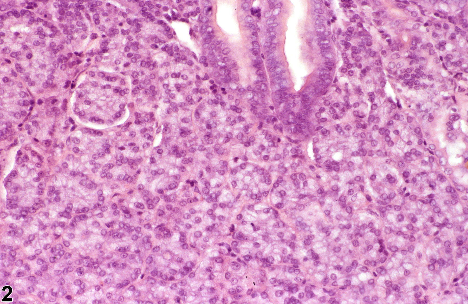 Image of hyperplasia in the glandular stomach neuroendocrine cell from a female F344/N rat in a chronic study