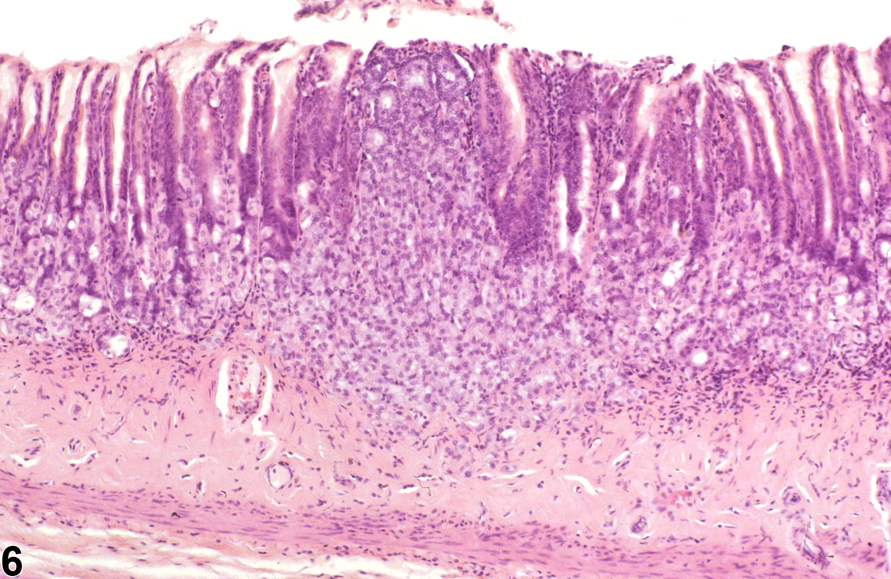 Image of hyperplasia (Sevier-Munger stain) in the glandular stomach neuroendocrine cell from a female F344/N rat in a chronic study