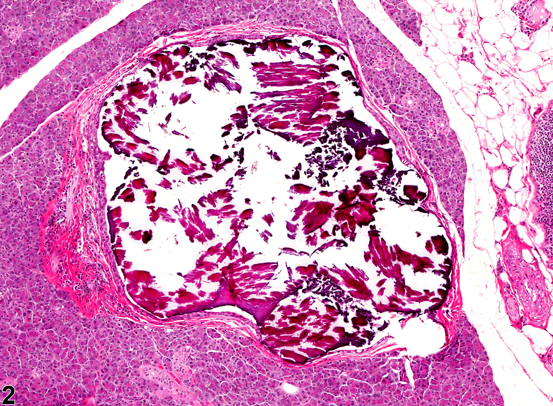 Image of concretion in the salivary gland duct from a female F344/N rat in a subchronic study