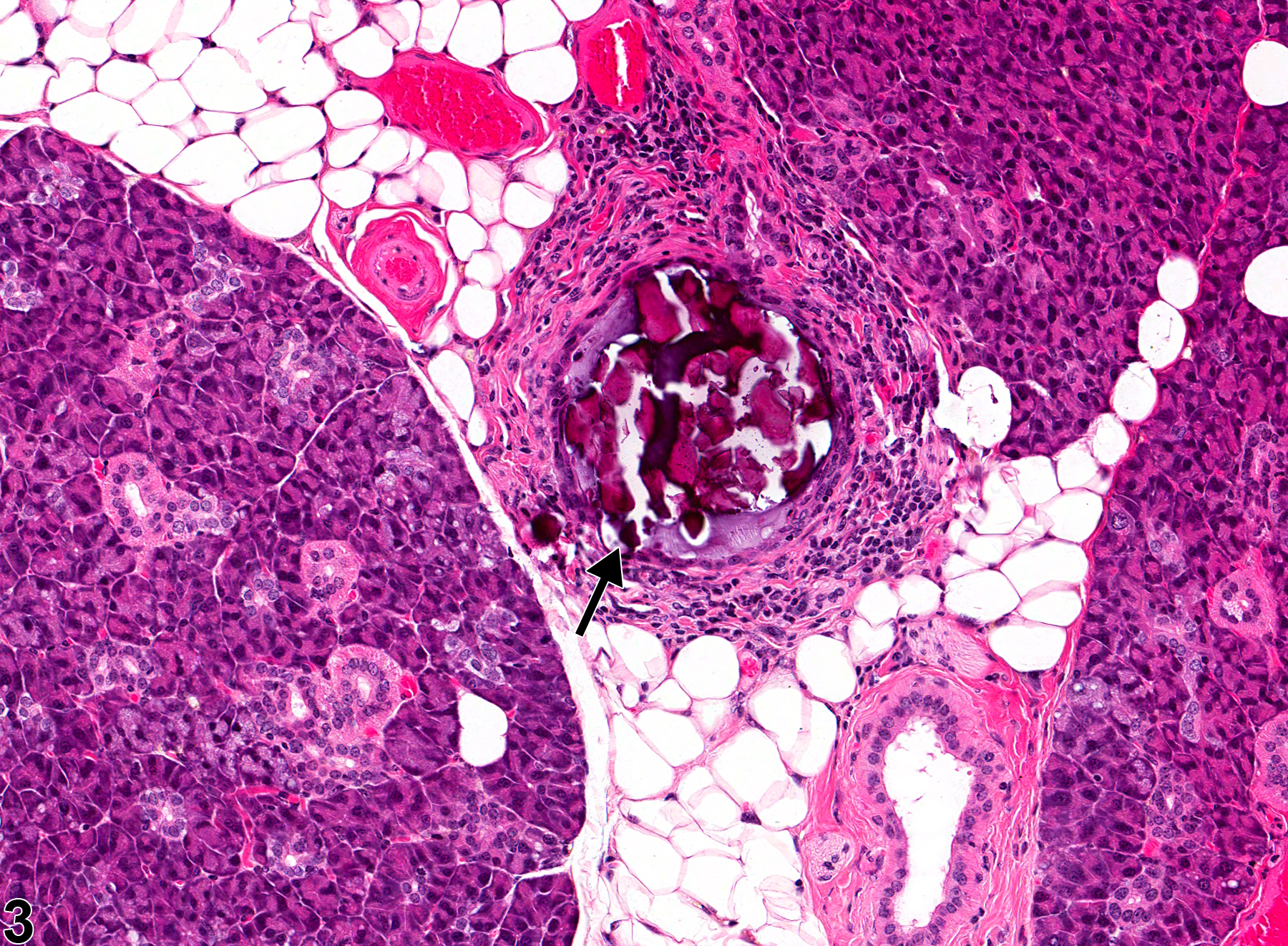 Image of concretion in the salivary gland duct from a male B6C3F1 mouse in a subchronic study