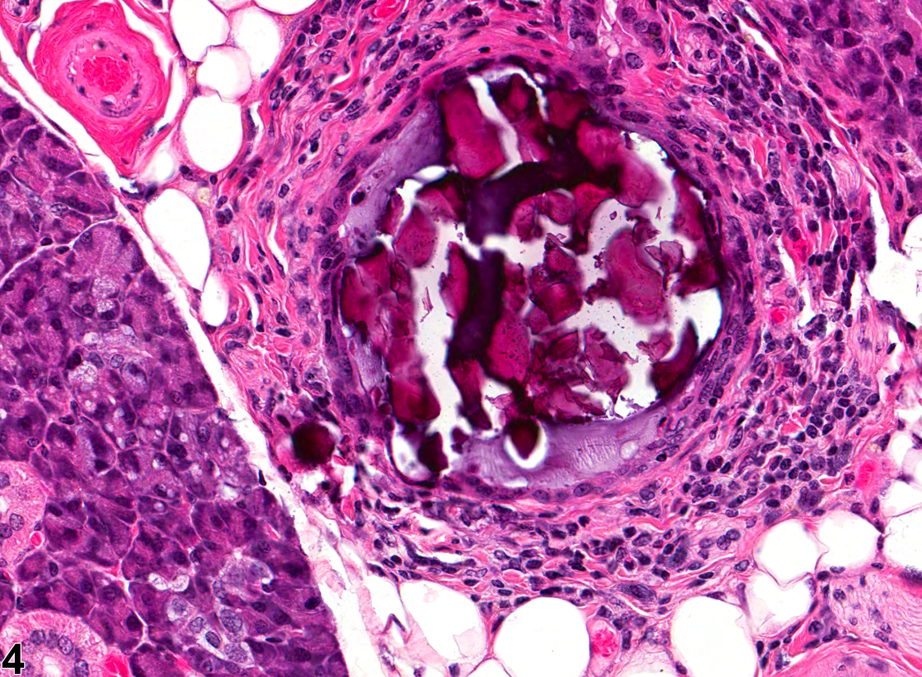 Image of concretion in the salivary gland duct from a male B6C3F1 mouse in a subchronic study