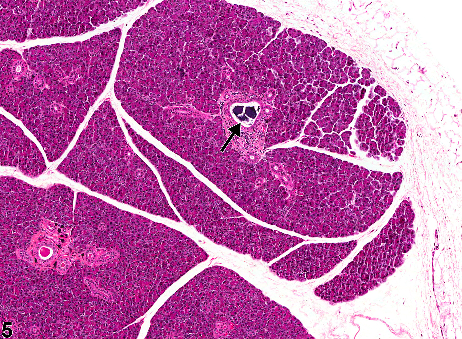 Image of concretion in the salivary gland duct from a female F344/N rat in a acute study