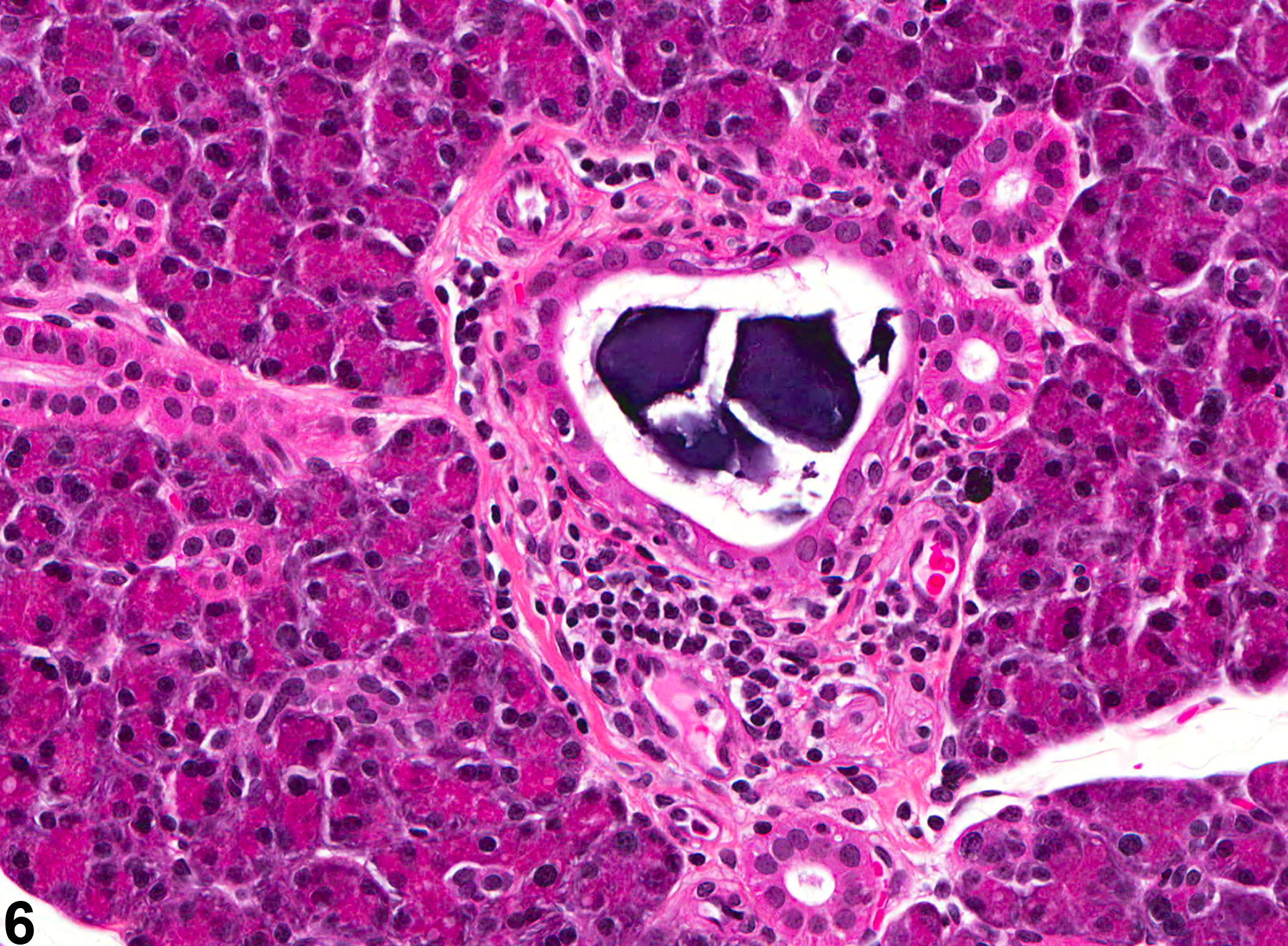 Image of concretion in the salivary gland duct from a female F344/N rat in a acute study