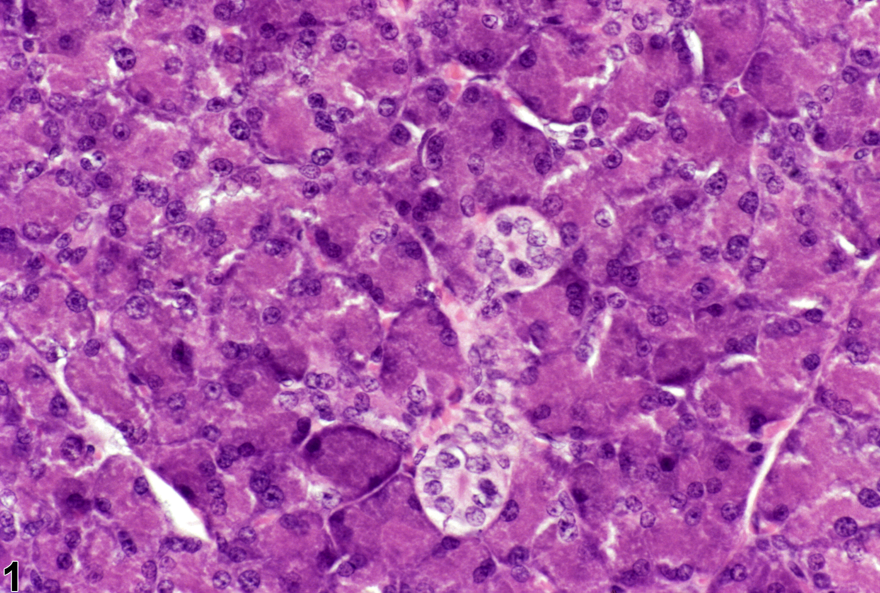 Image of normal comparison to hypertrophy in the parotid salivary gland acinus from a male F344/N rat in a subchronic study