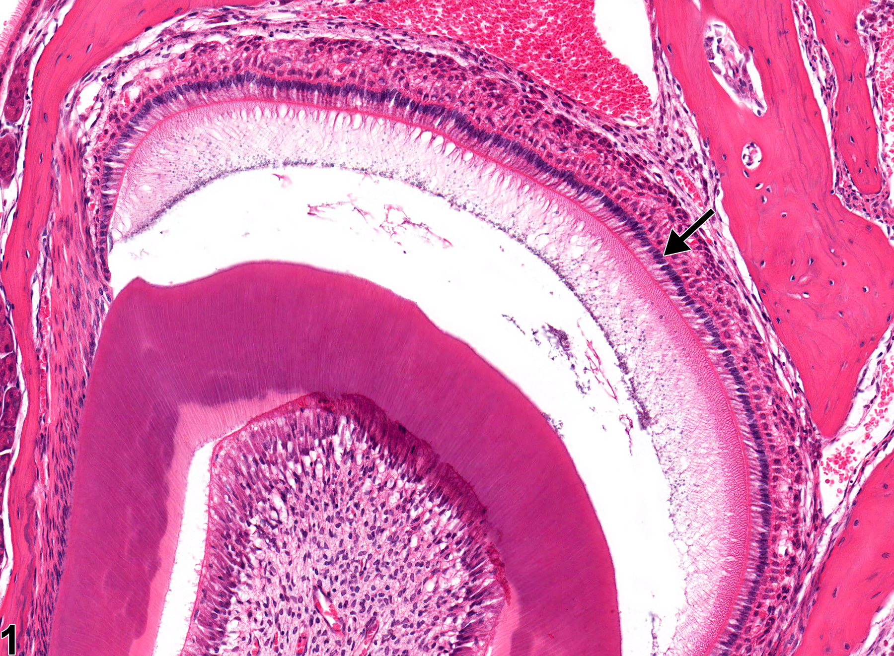 Image of normal ameloblast comparison to metaplasia, squamous in the tooth from a male B6C3F1 mouse in a chronic study