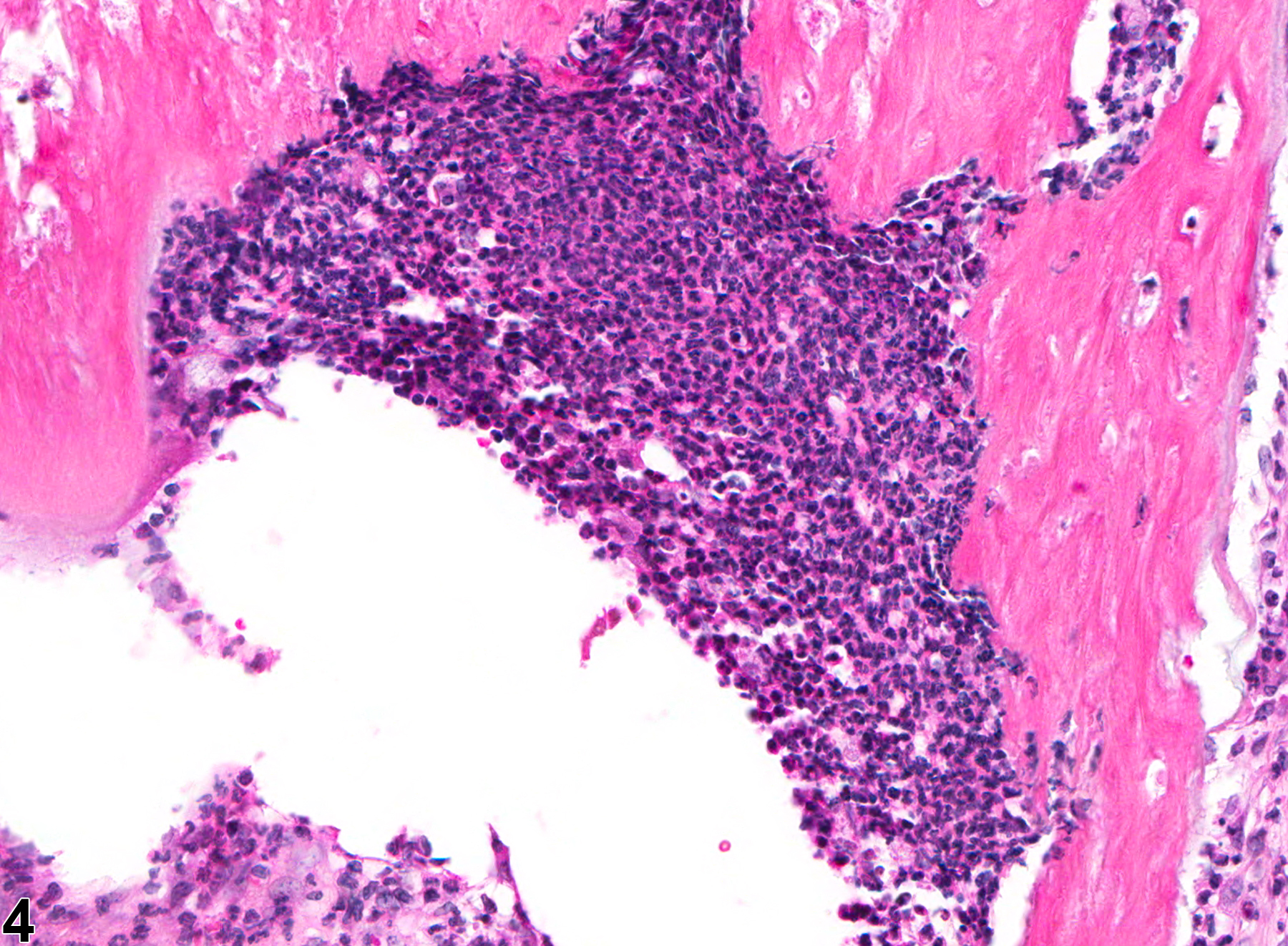 Image of inflammation in the tooth from a male B6C3F1 mouse in a chronic study