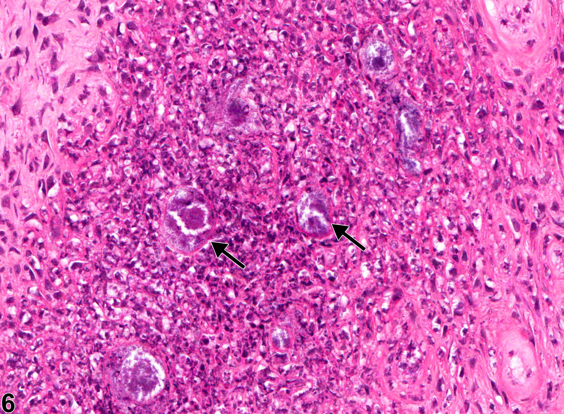 Image of inflammation in the tooth from a male F344/N rat in a chronic study