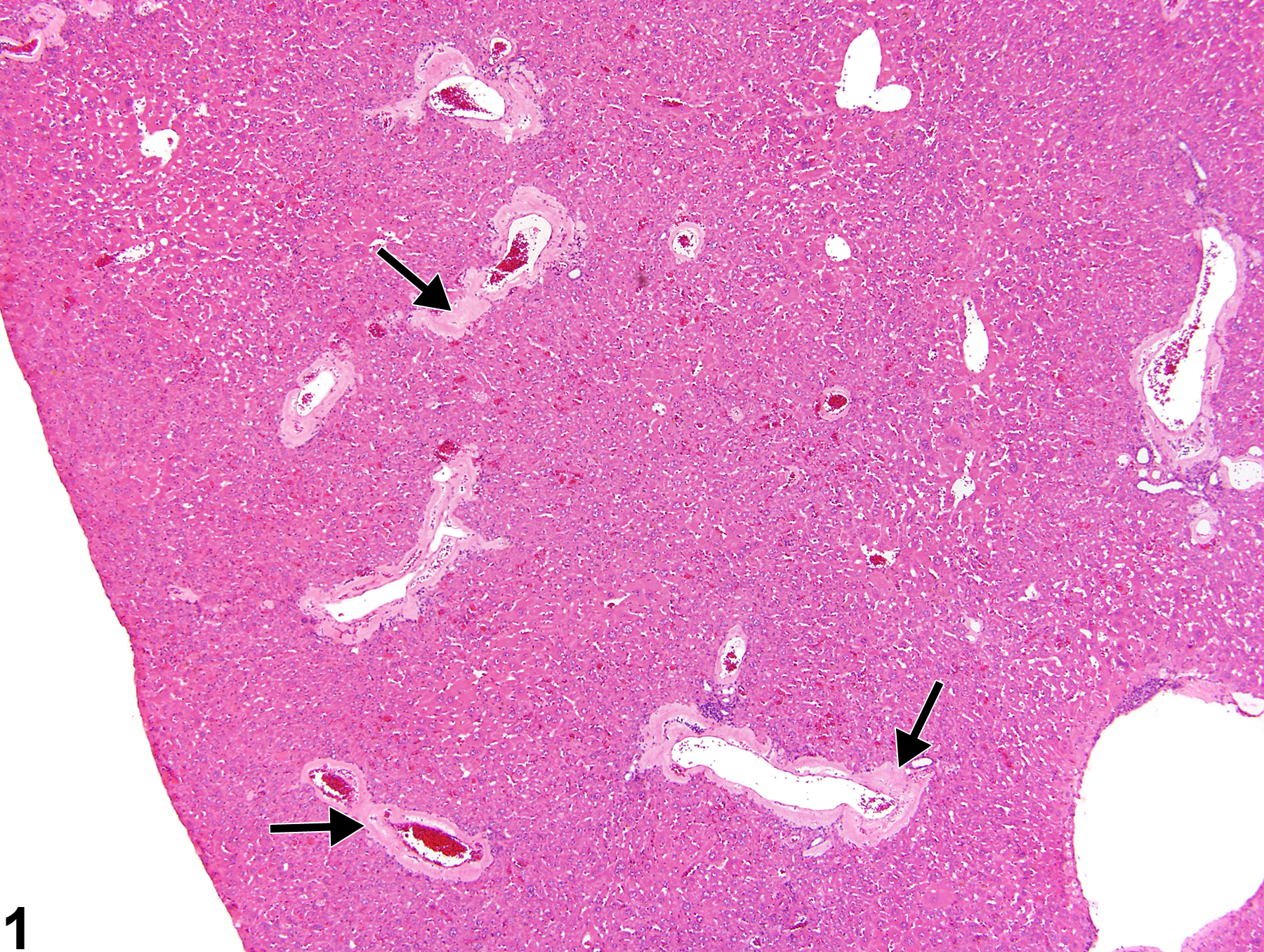 Image of amyloid in the liver, artery from a male Swiss Webster mouse in a chronic study