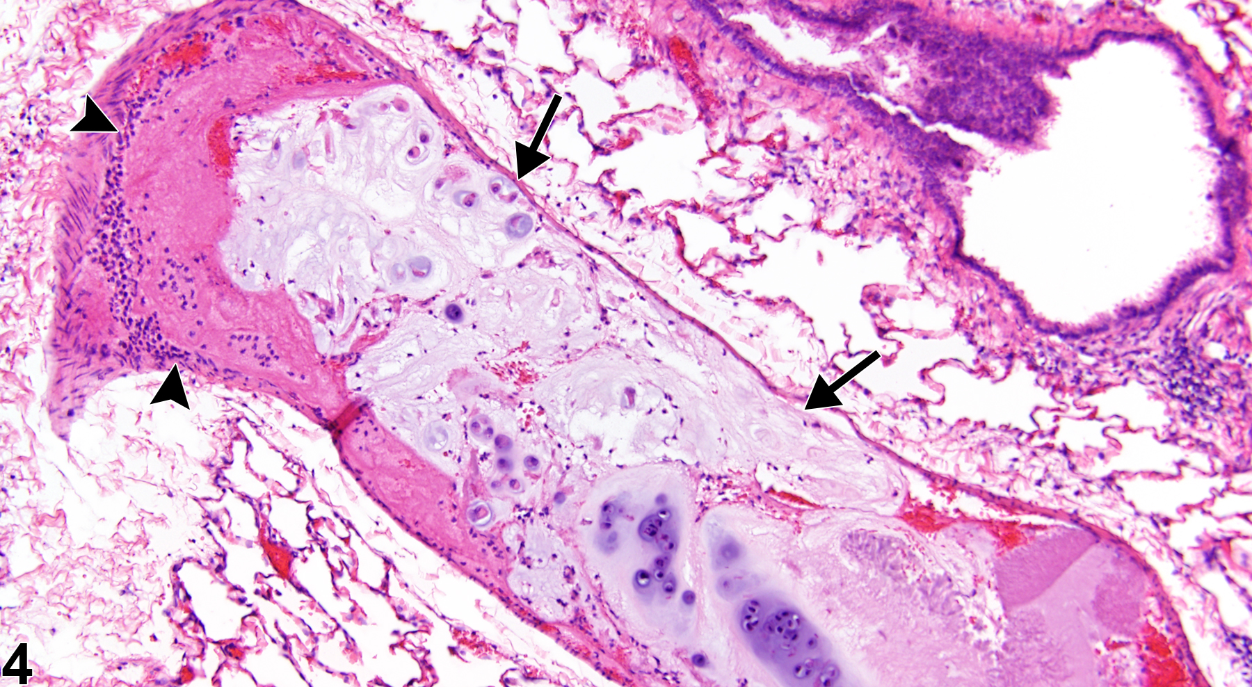 Image of embolus, cartilage in the lung, vein from a male F344/N rat in a chronic study