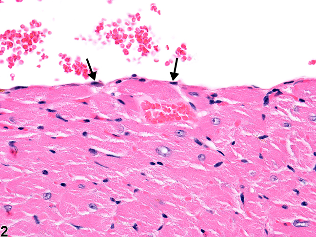 Image of normal heart from a male B6C3F1/N mouse in a chronic study