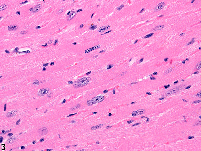 Image of normal heart from a male B6C3F1/N mouse in a chronic study