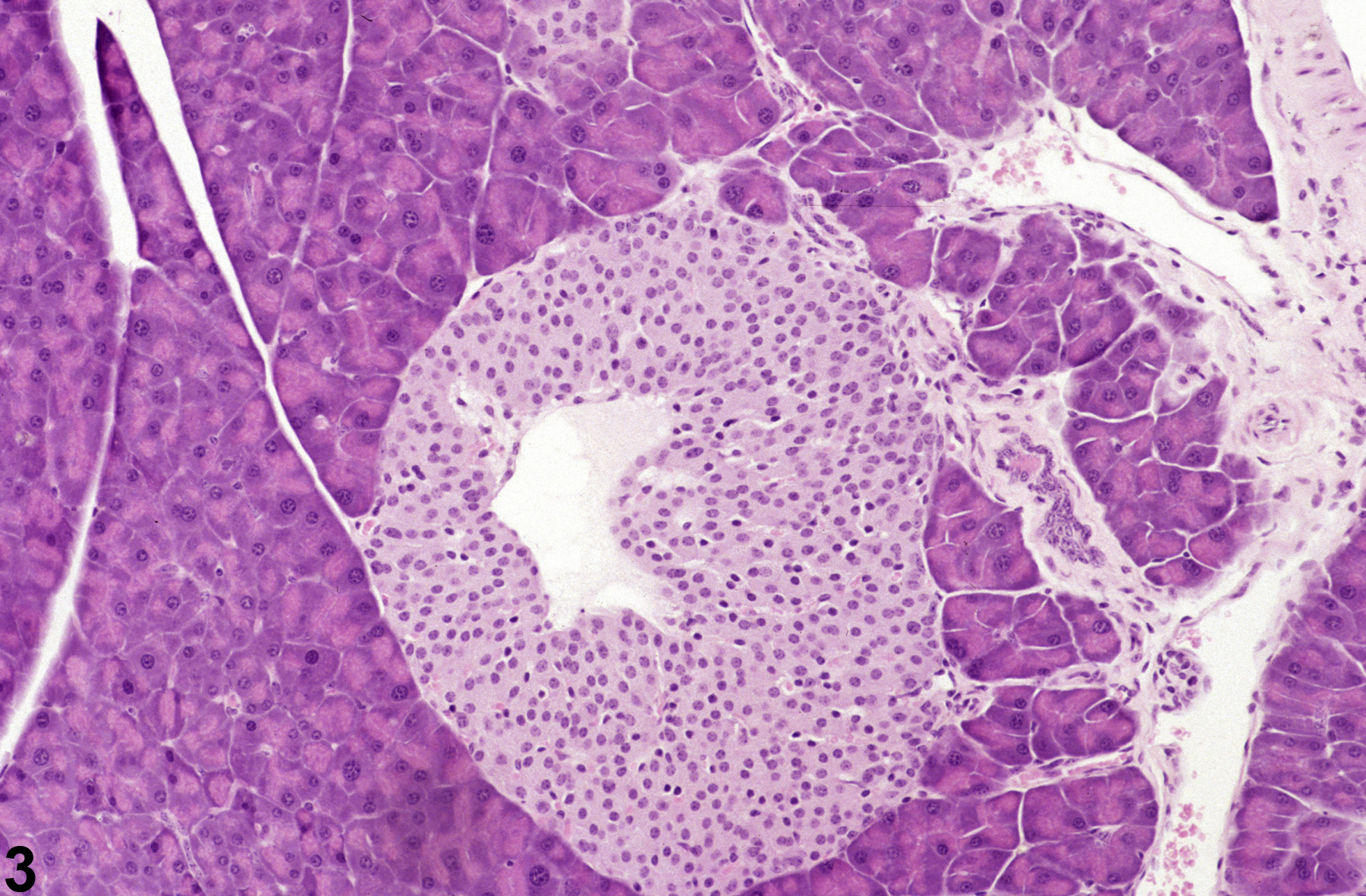 Image of cyst in the pancreatic islet from a male B6C3F1 mouse in a chronic study