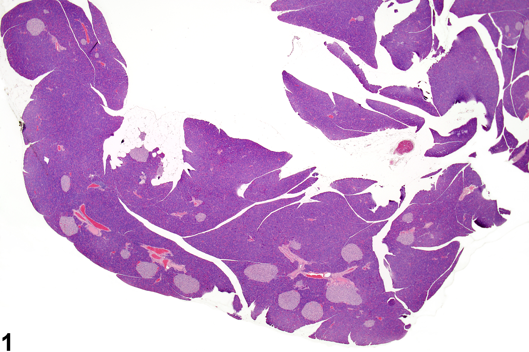 Image of hyperplasia (normal comparison) in the pancreatic islet from a male B6C3F1 mouse in a chronic study