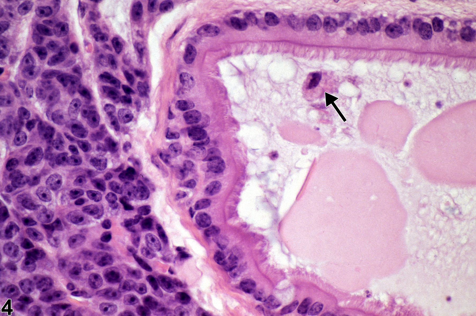 Image of cyst, congenital in the parathyroid gland from a male B6C3F1 mouse in a chronic study