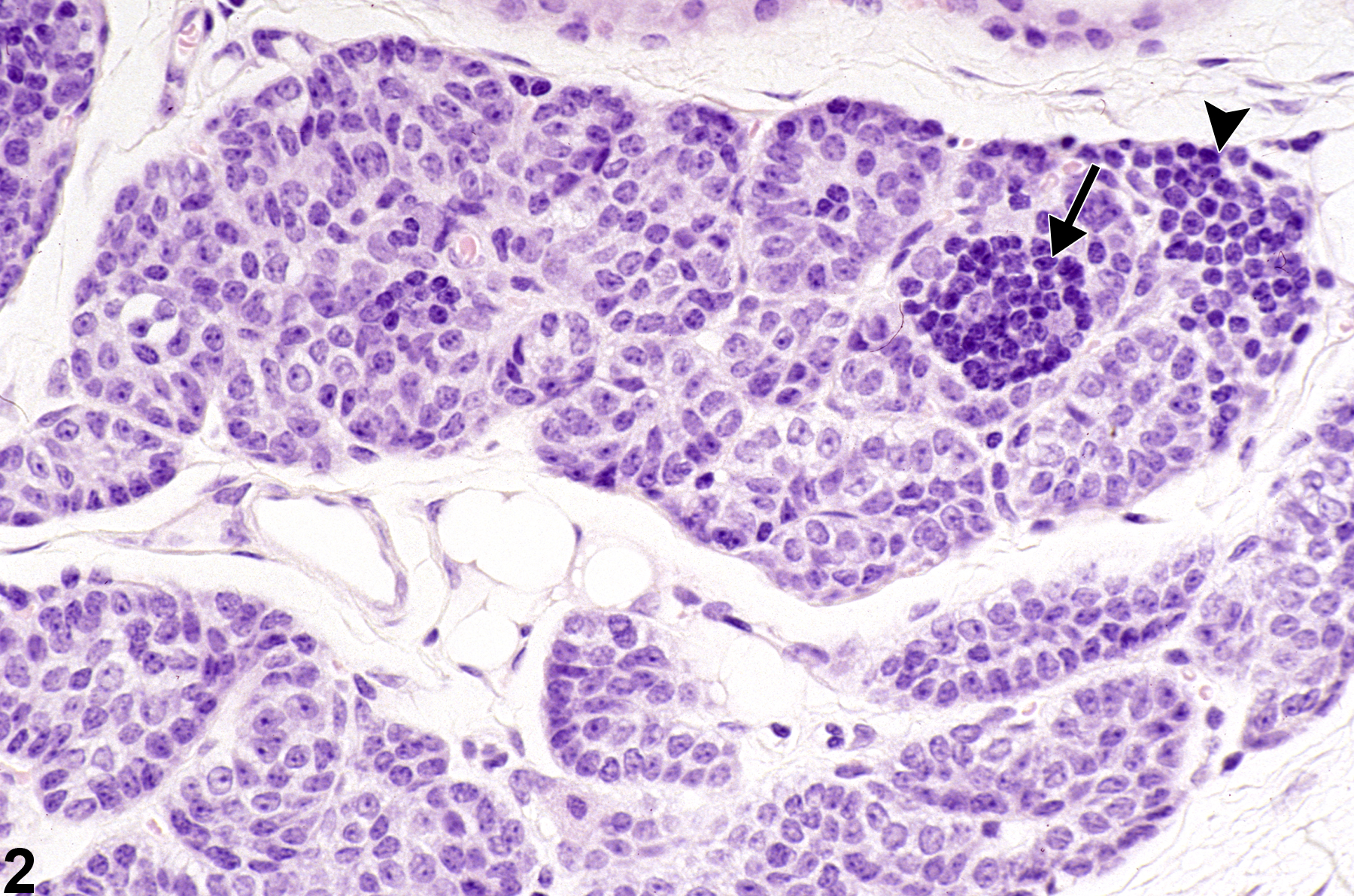 Image of ectopic tissue in the parathyroid gland from a female B6C3F1 mouse in a subchronic study