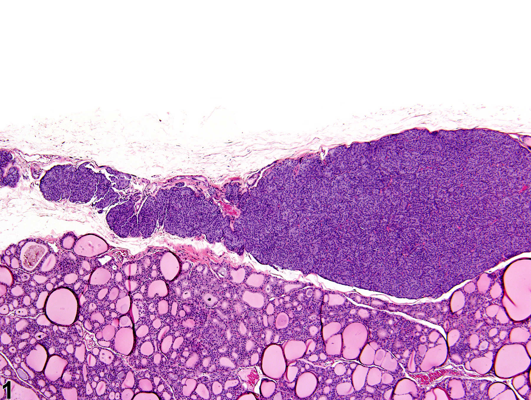 Image of hyperplasia, diffuse in the parathyroid gland from a male F344/N rat in a chronic study