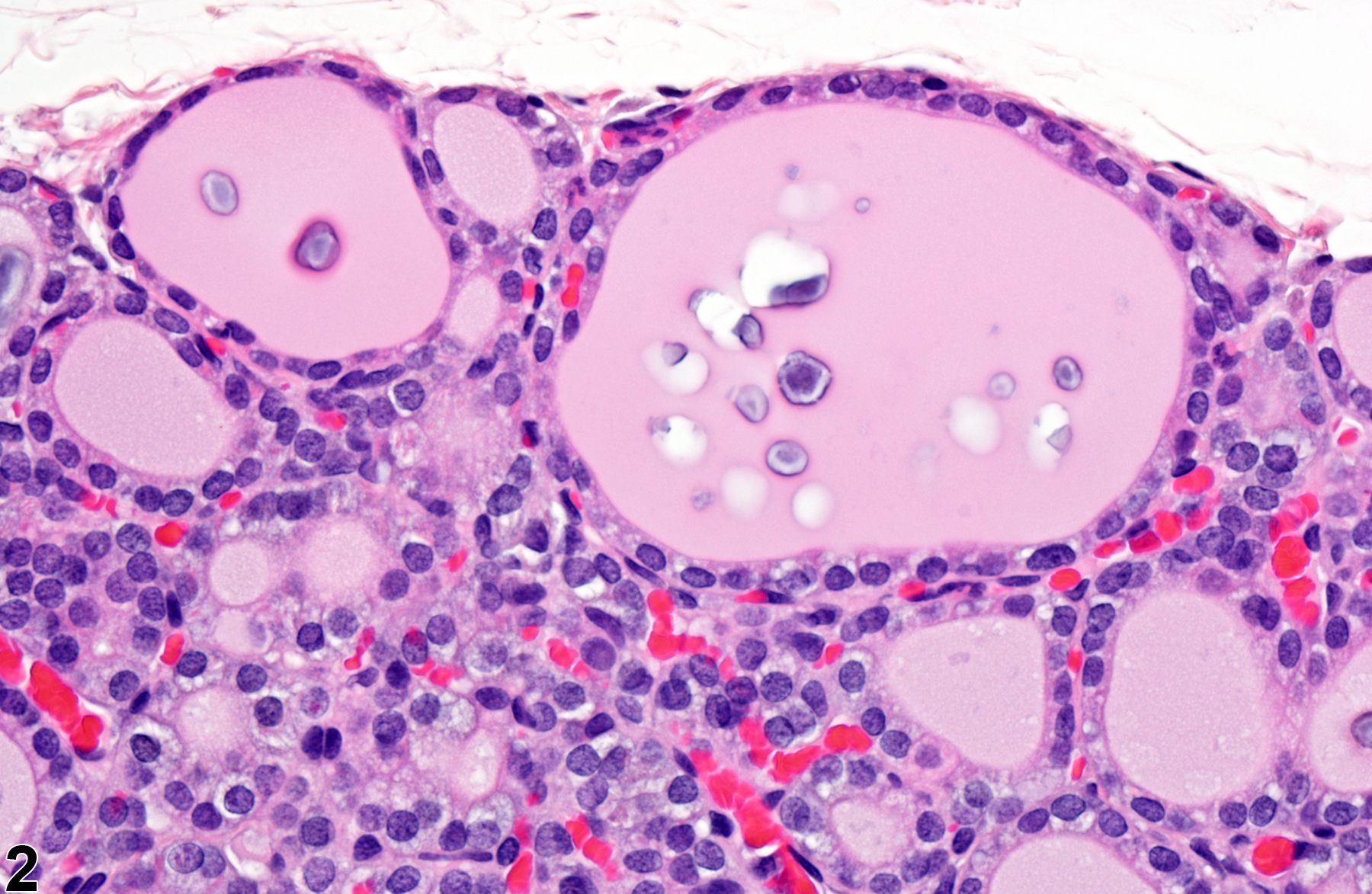 Image of follicle mineralization in the thyroid gland from a male F344/N rat in a chronic study