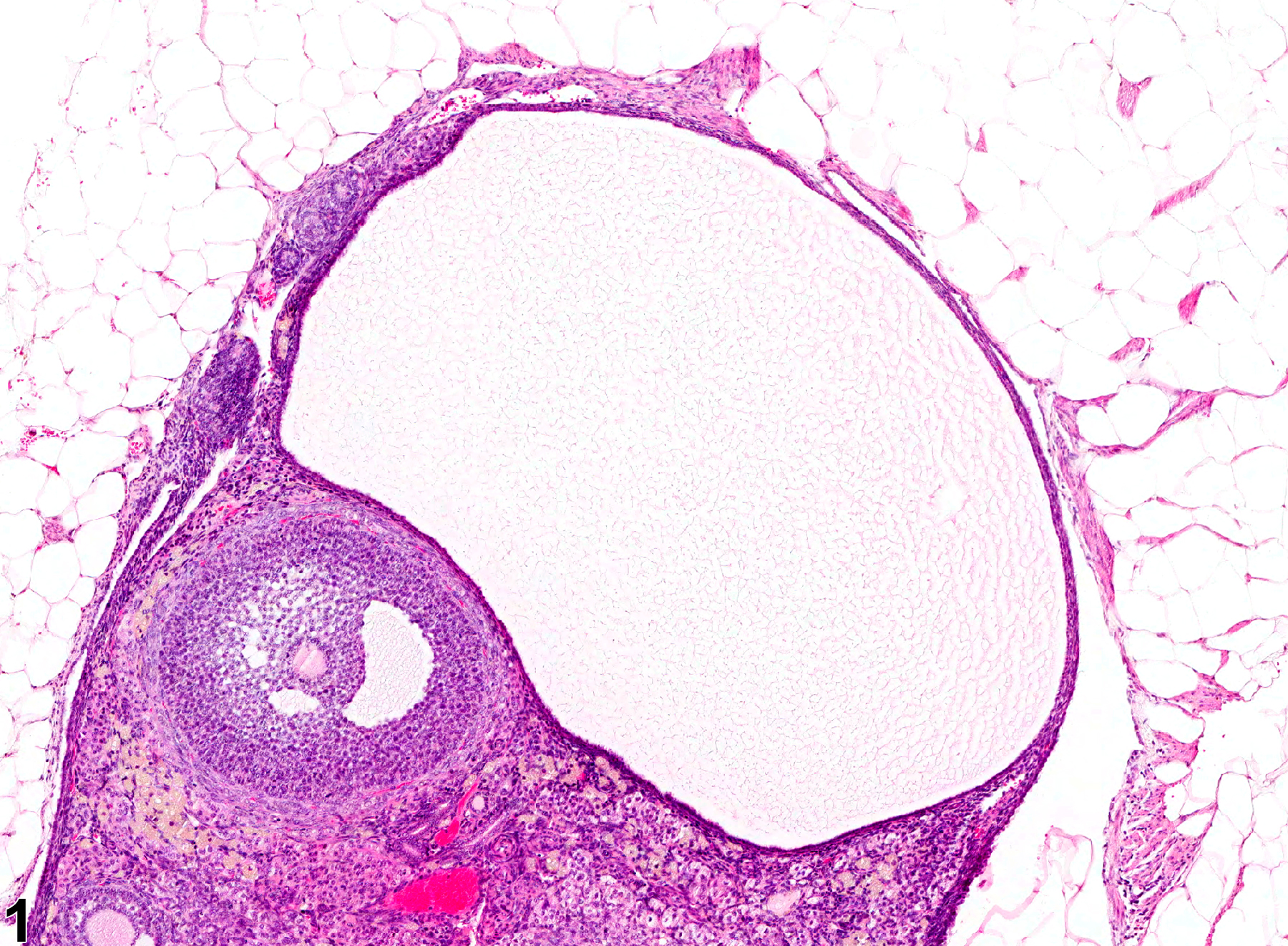 Image of follicular cyst in the ovary from a female B6C3F1 mouse in a chronic study