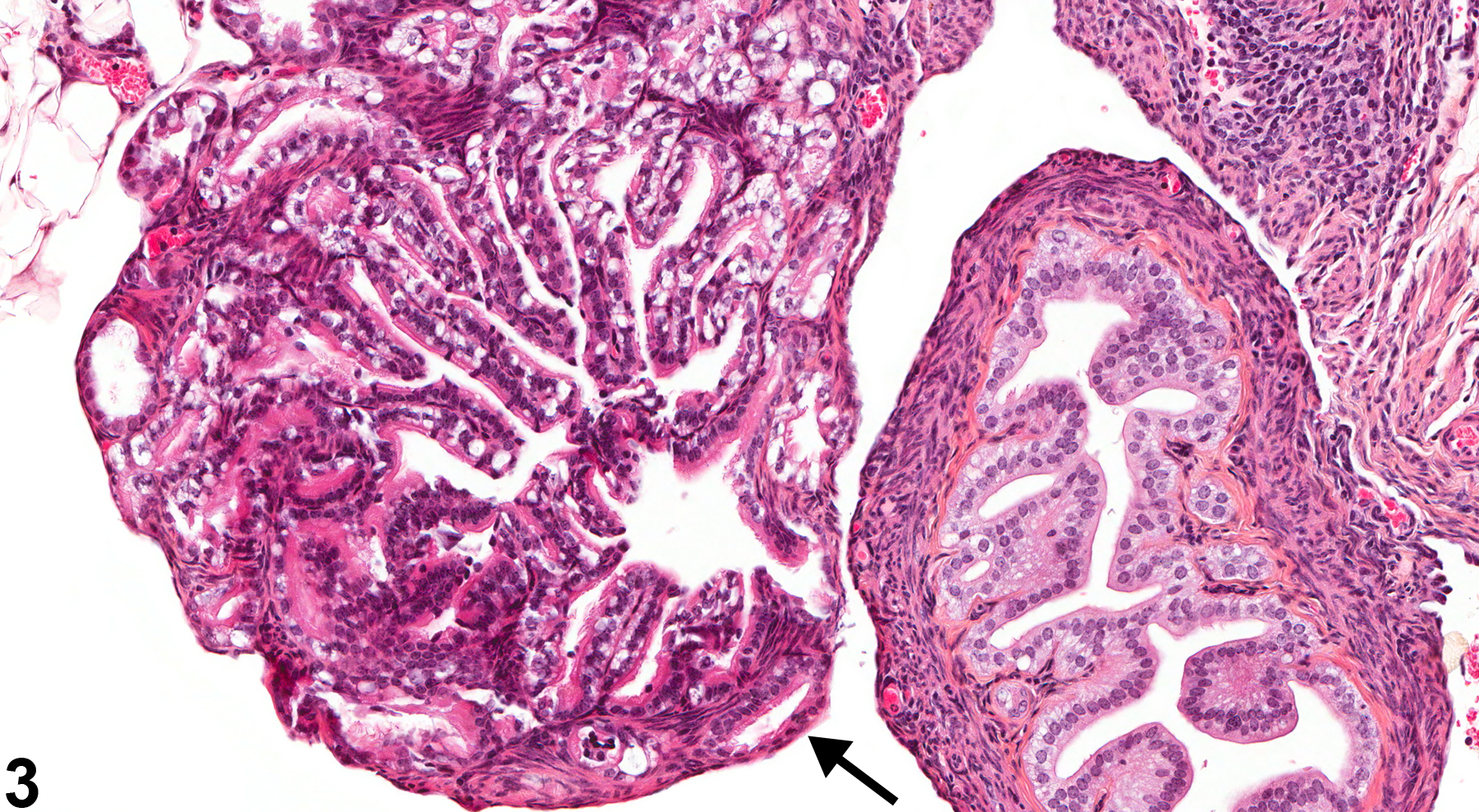 Image of atrophy in the oviduct from a female B6C3F1 mouse in a chronic study