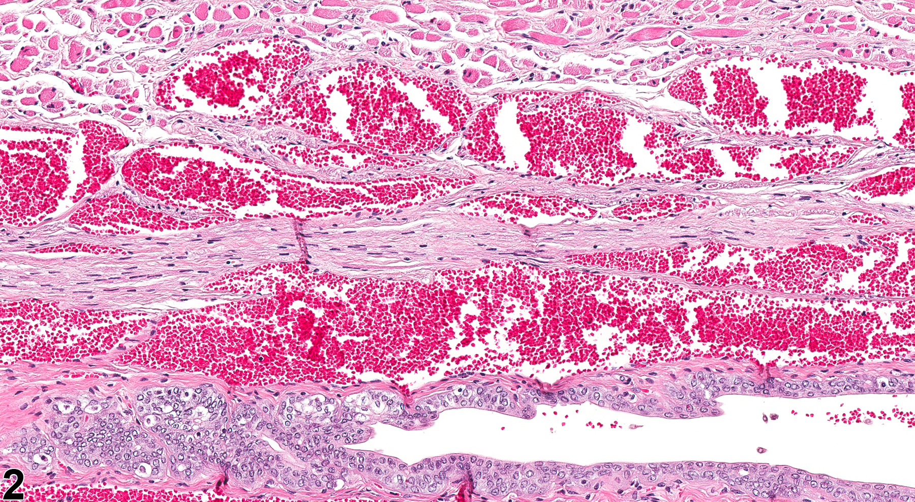 Image of angiectasis in the vagina from a female F344/N rat in a chronic study