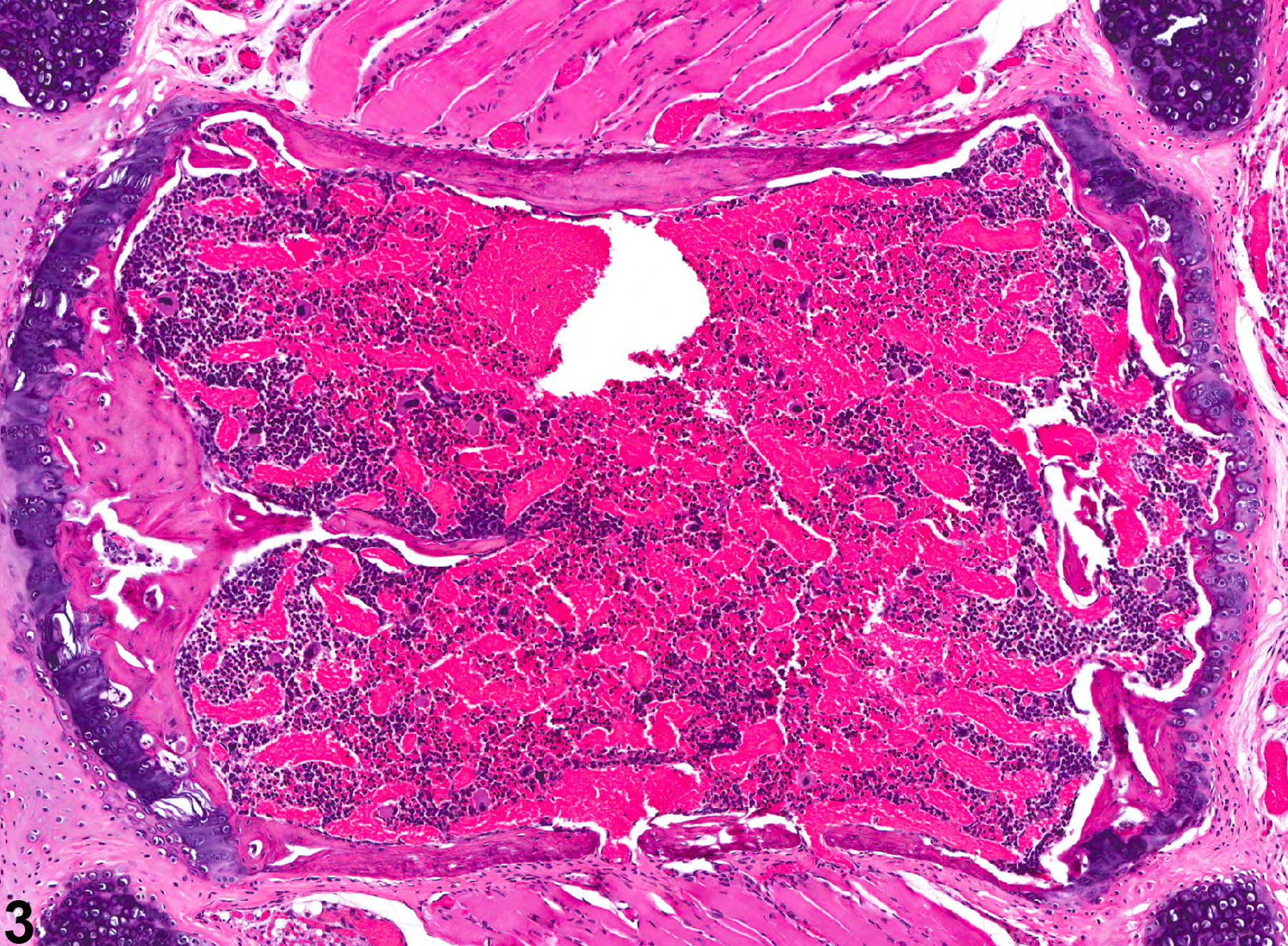 Image of angiectasis in the bone marrow from a female B6C3F1 mouse in a chronic study