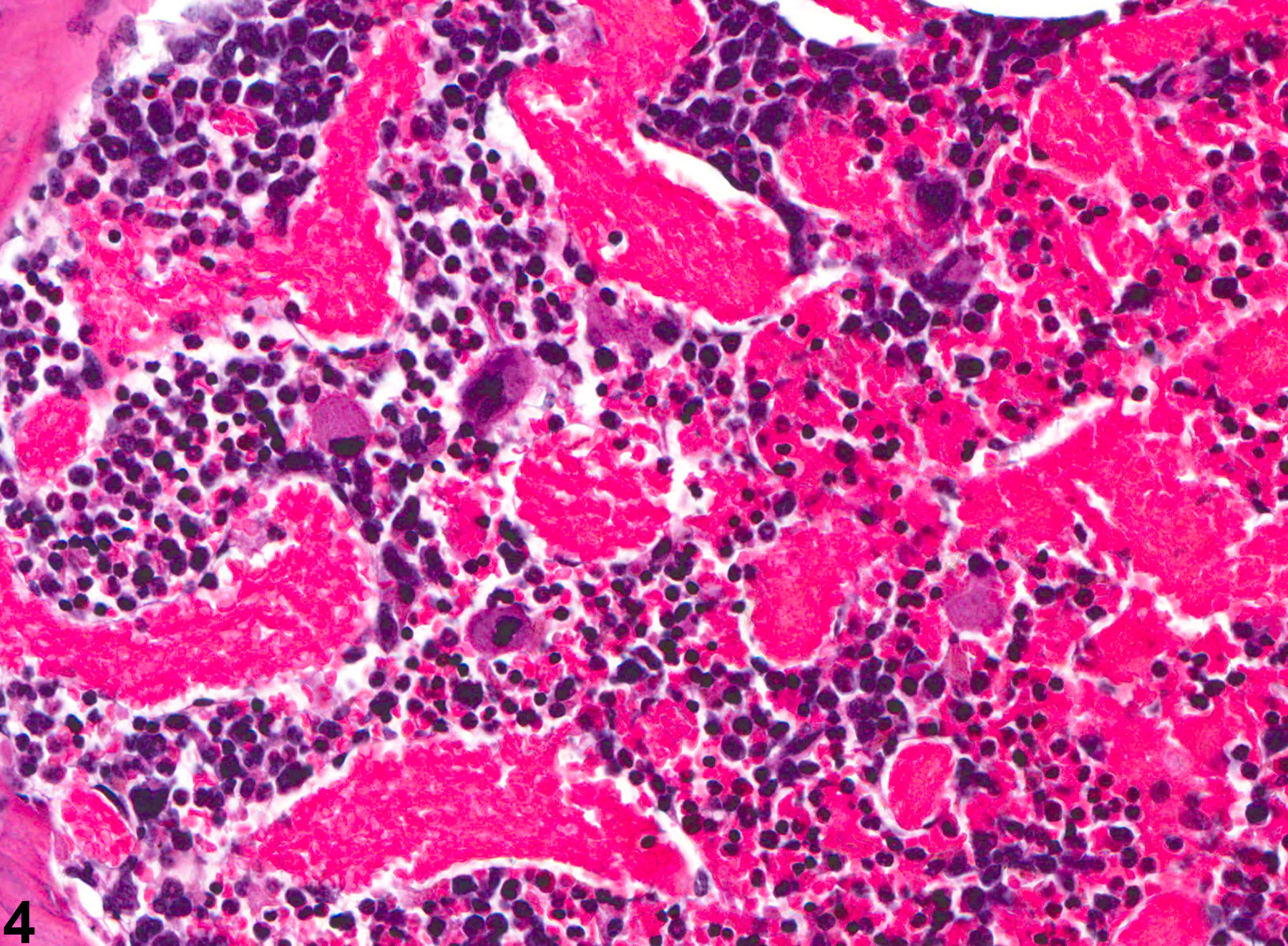 Image of angiectasis in the bone marrow from a female B6C3F1 mouse in a chronic study