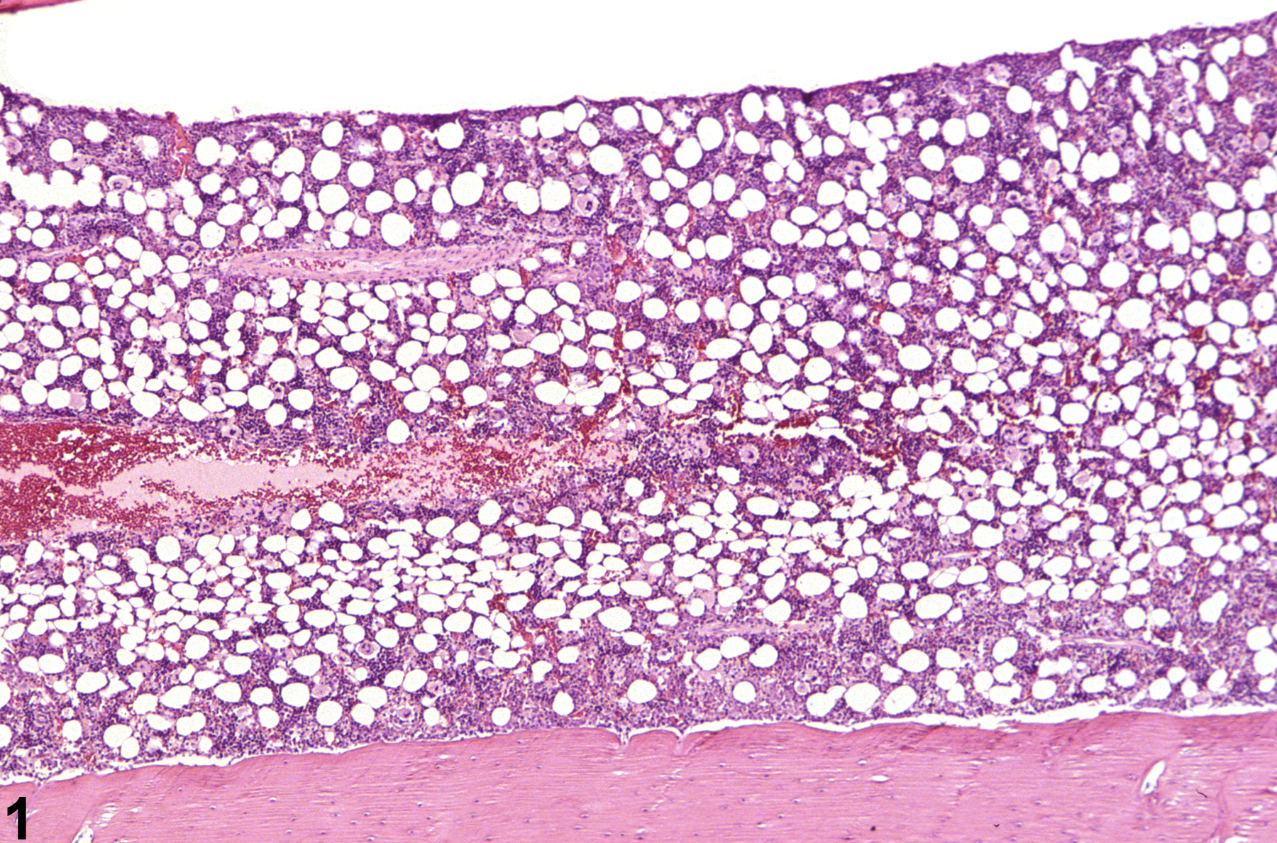 Image of hypocellularity (normal comparison) in the bone marrow from a female F344/N rat in a subchronic study