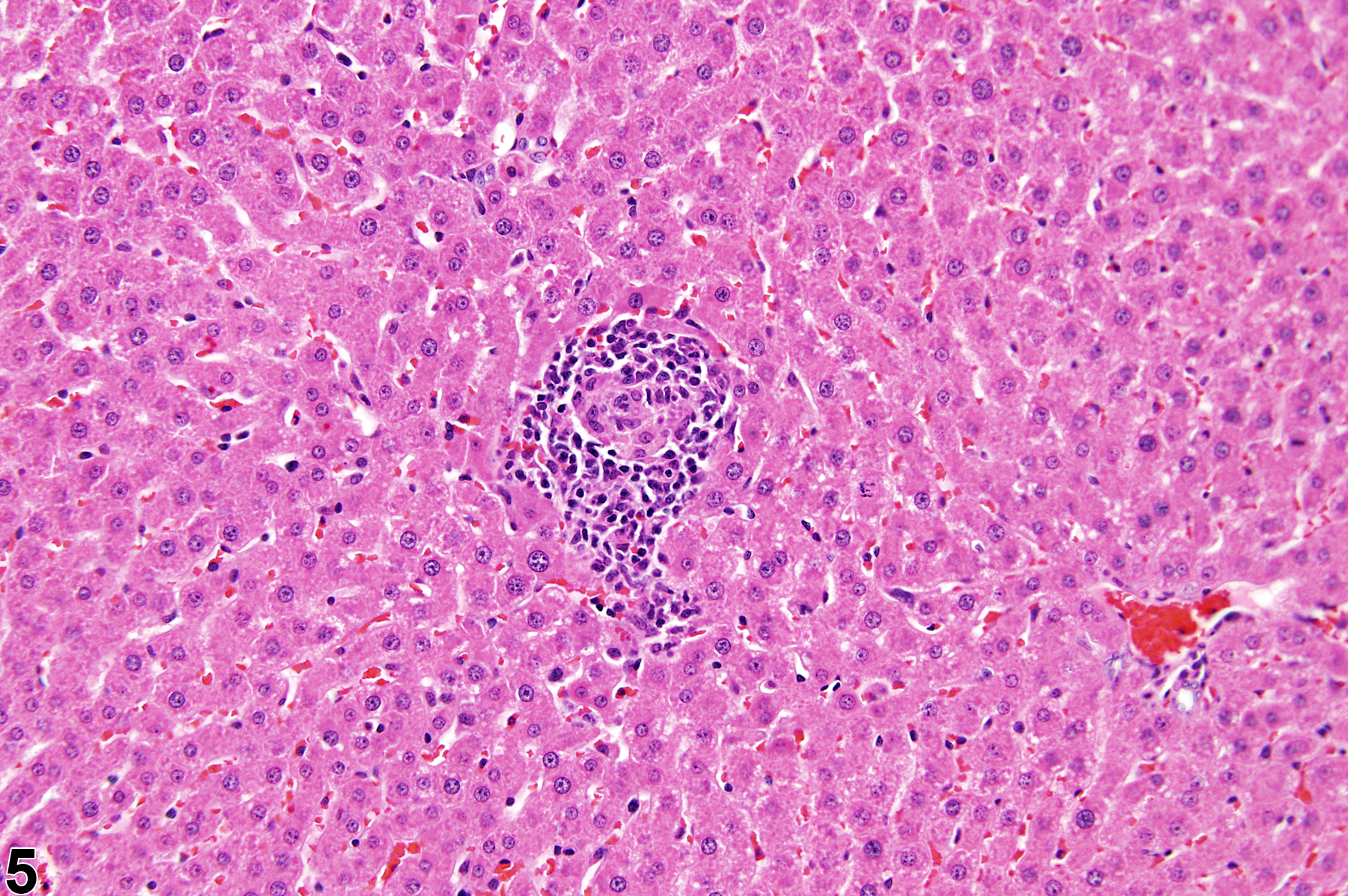 Image of inflammation in the liver from a female F344/N rat in a subchronic study