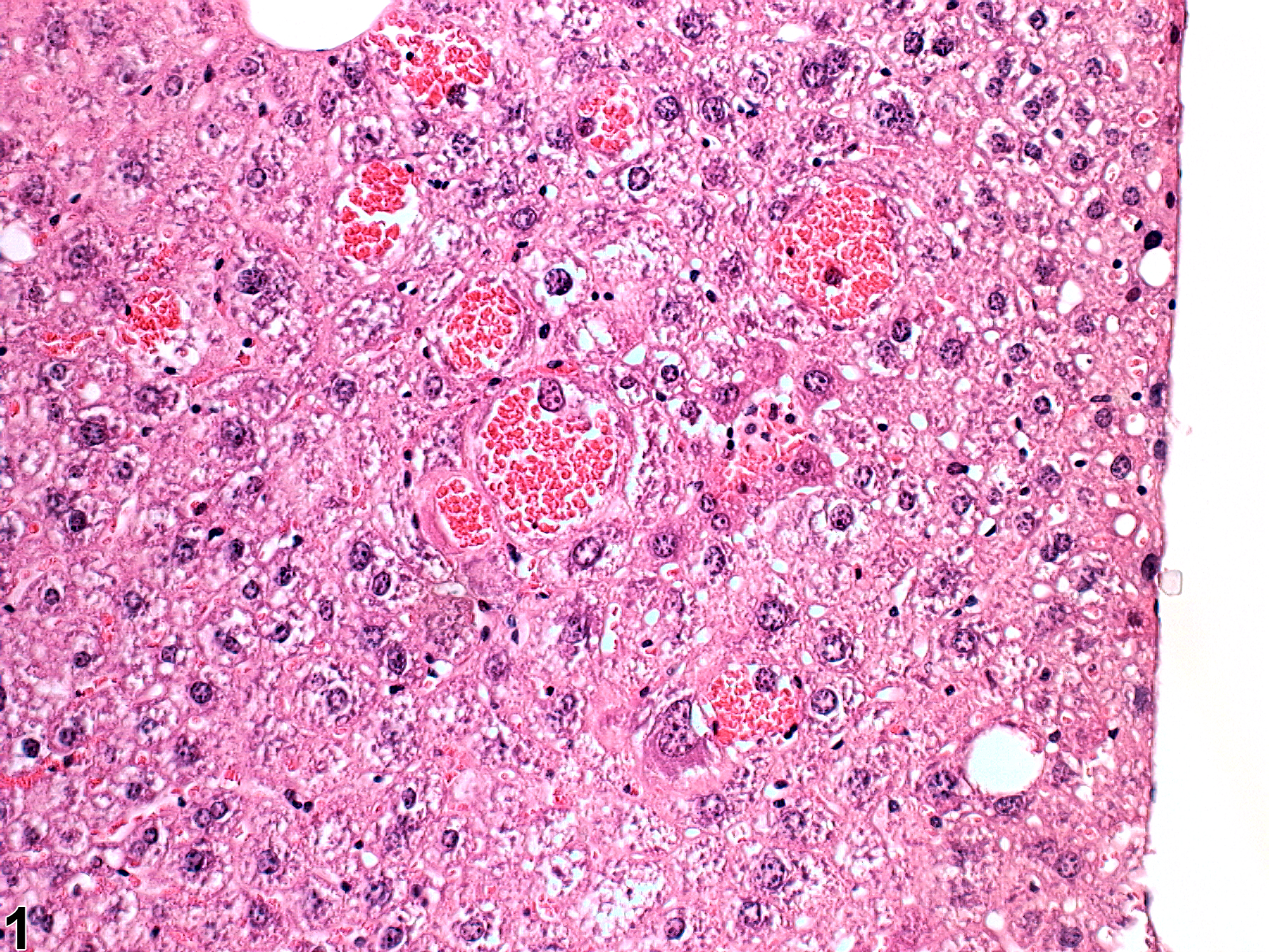 Image of Intrahepatocellular erythrocytes in the Liver from a Male  B6C3F1 Mouse in a 2 year  Study