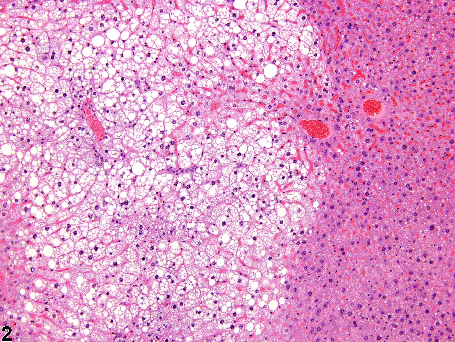 Image of tension lipidosis in the liver from a male B6C3F1 mouse in a chronic study