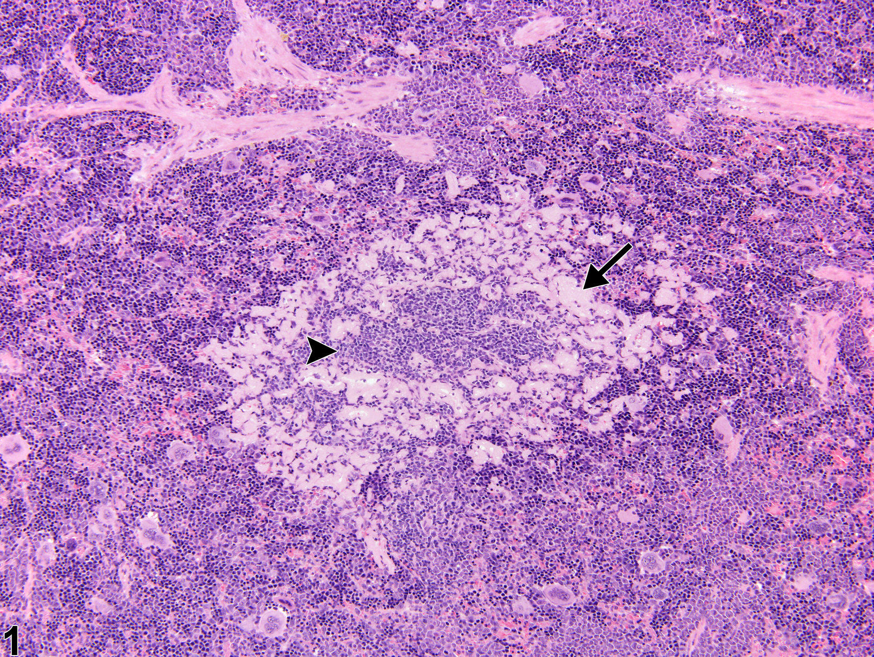 Image of amyloid in the spleen from a male B6C3F1/N mouse in a chronic study