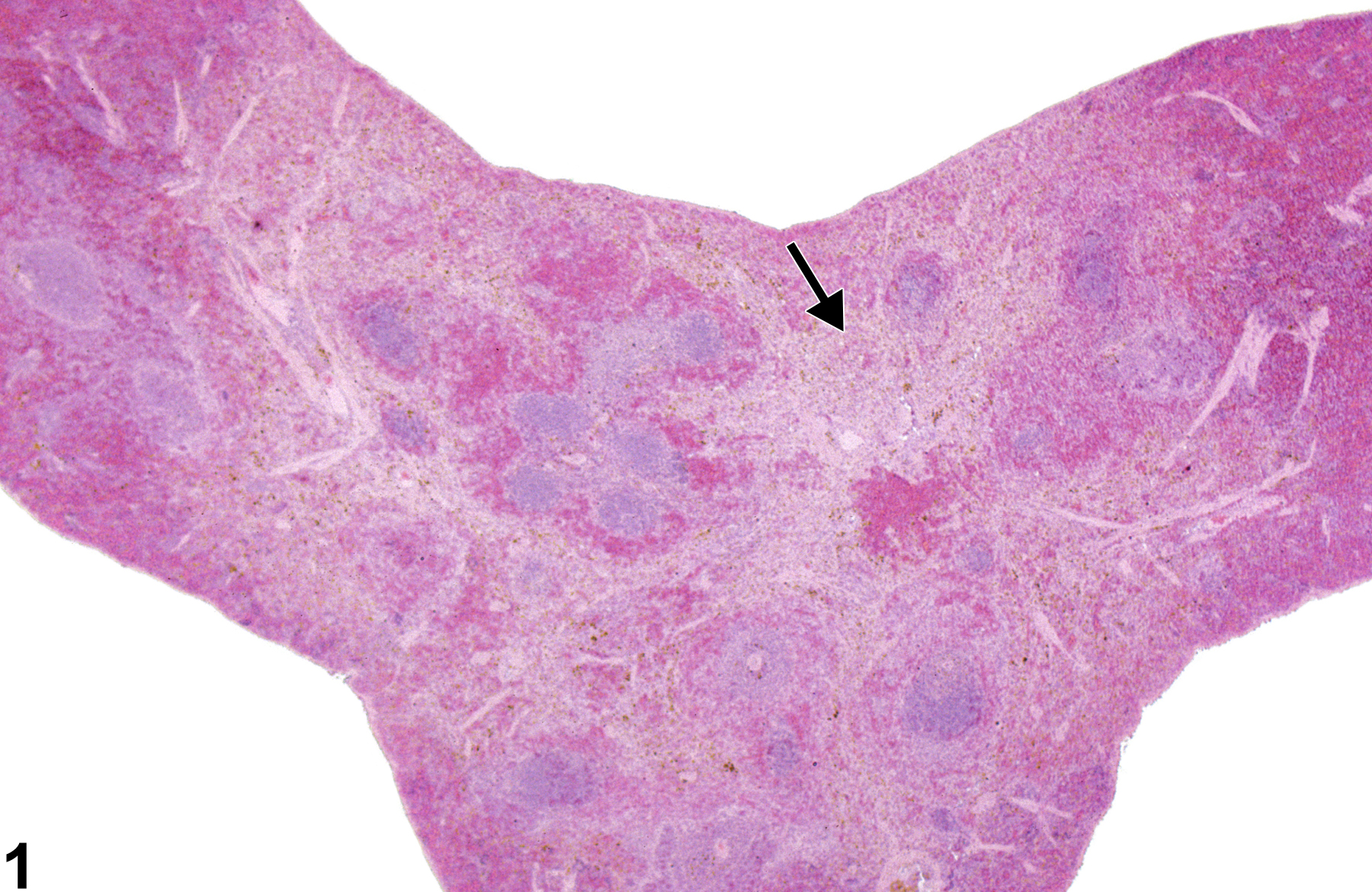 Image of fibrosis in the spleen from a male F344/N rat in a chronic study