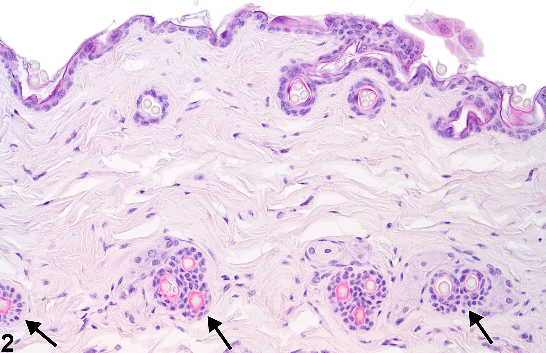 Image of atrophy in the skin adnexa from a male B6C3F1 mouse in a chronic study