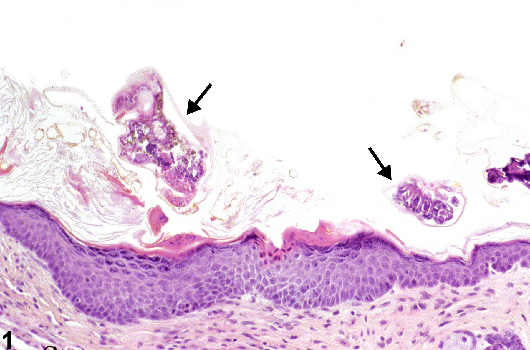 Image of ectoparasites in the skin from a female B6C3F1 mouse in a chronic study