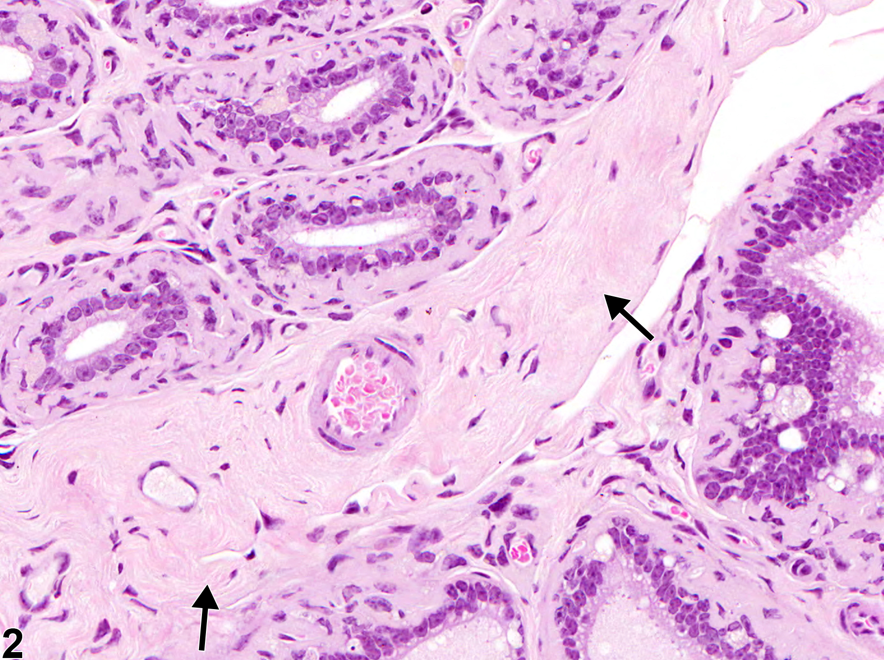 Image of amyloid in the epididymis from a male B6C3F1 mouse in a chronic study