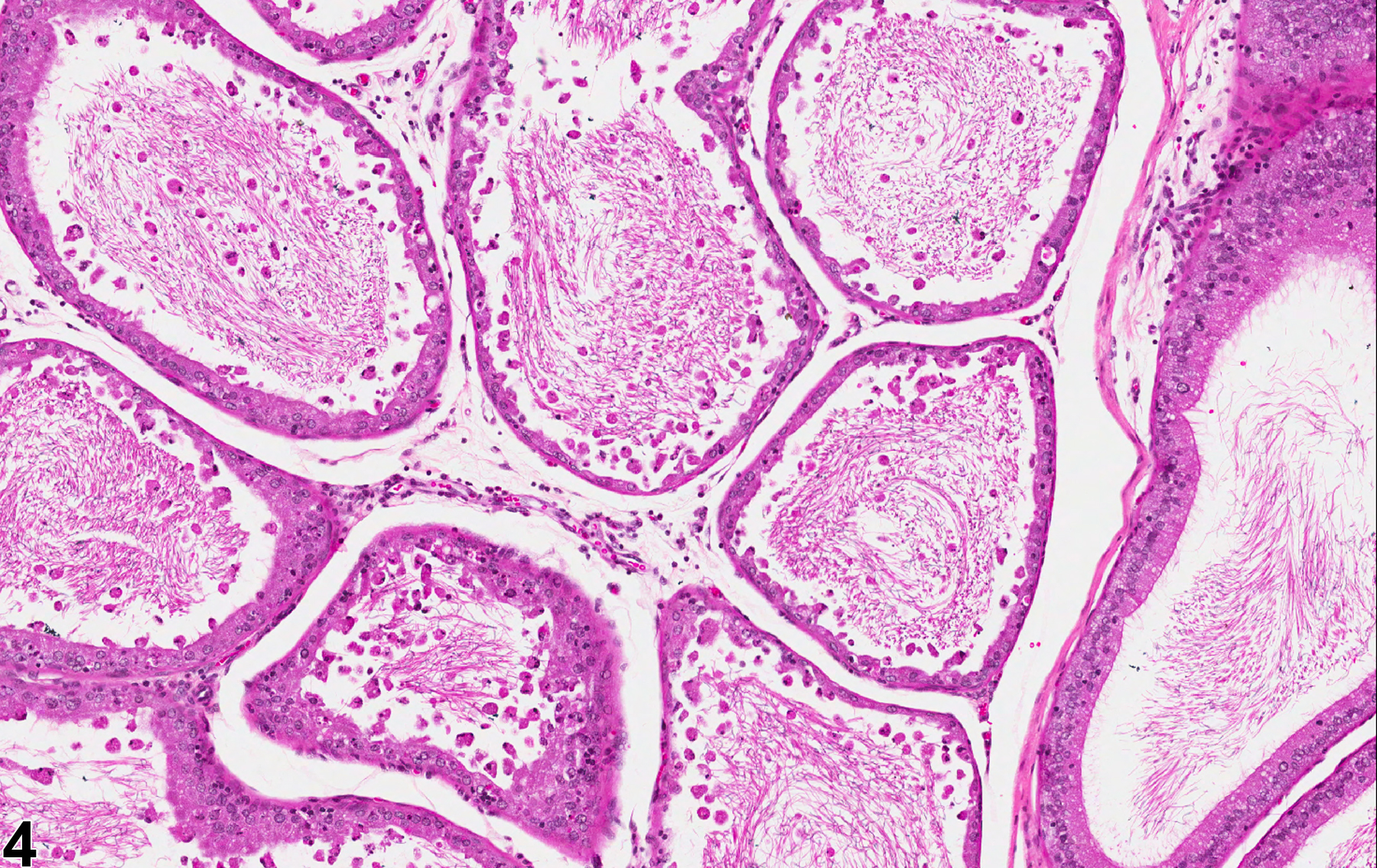 Image of epithelial degeneration in the epididymis from a  rat